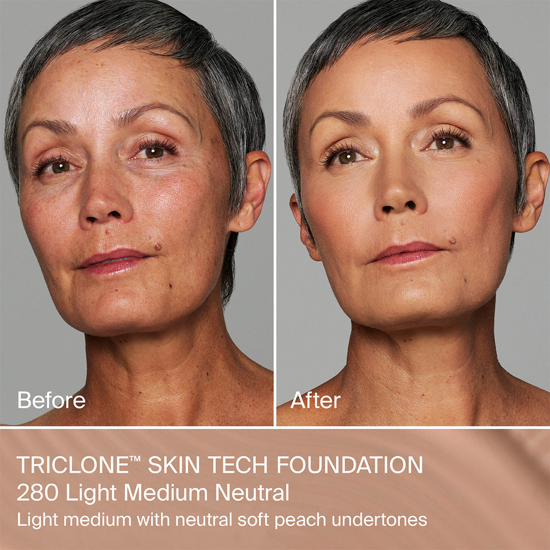 TRICLONE™ SKIN TECH MEDIUM COVERAGE FOUNDATION