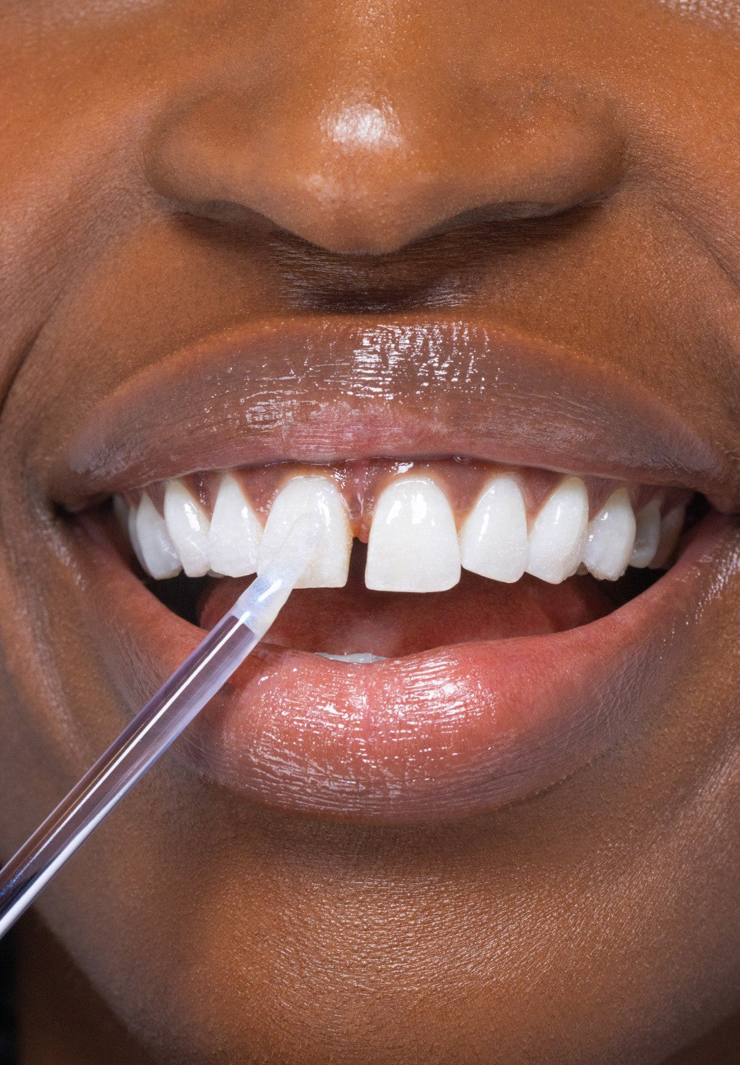 Instant Whitening Bundle