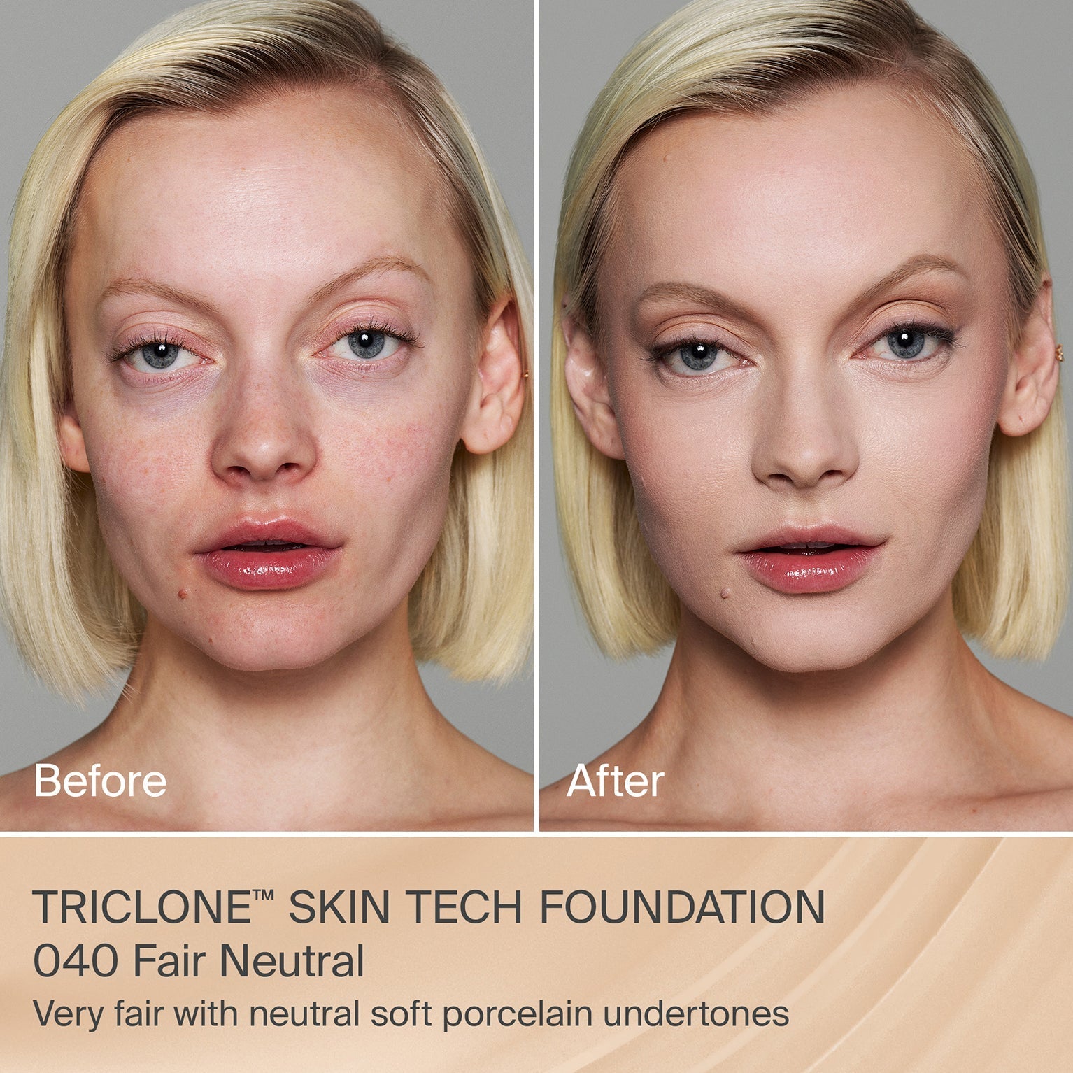 TRICLONE™ SKIN TECH MEDIUM COVERAGE FOUNDATION
