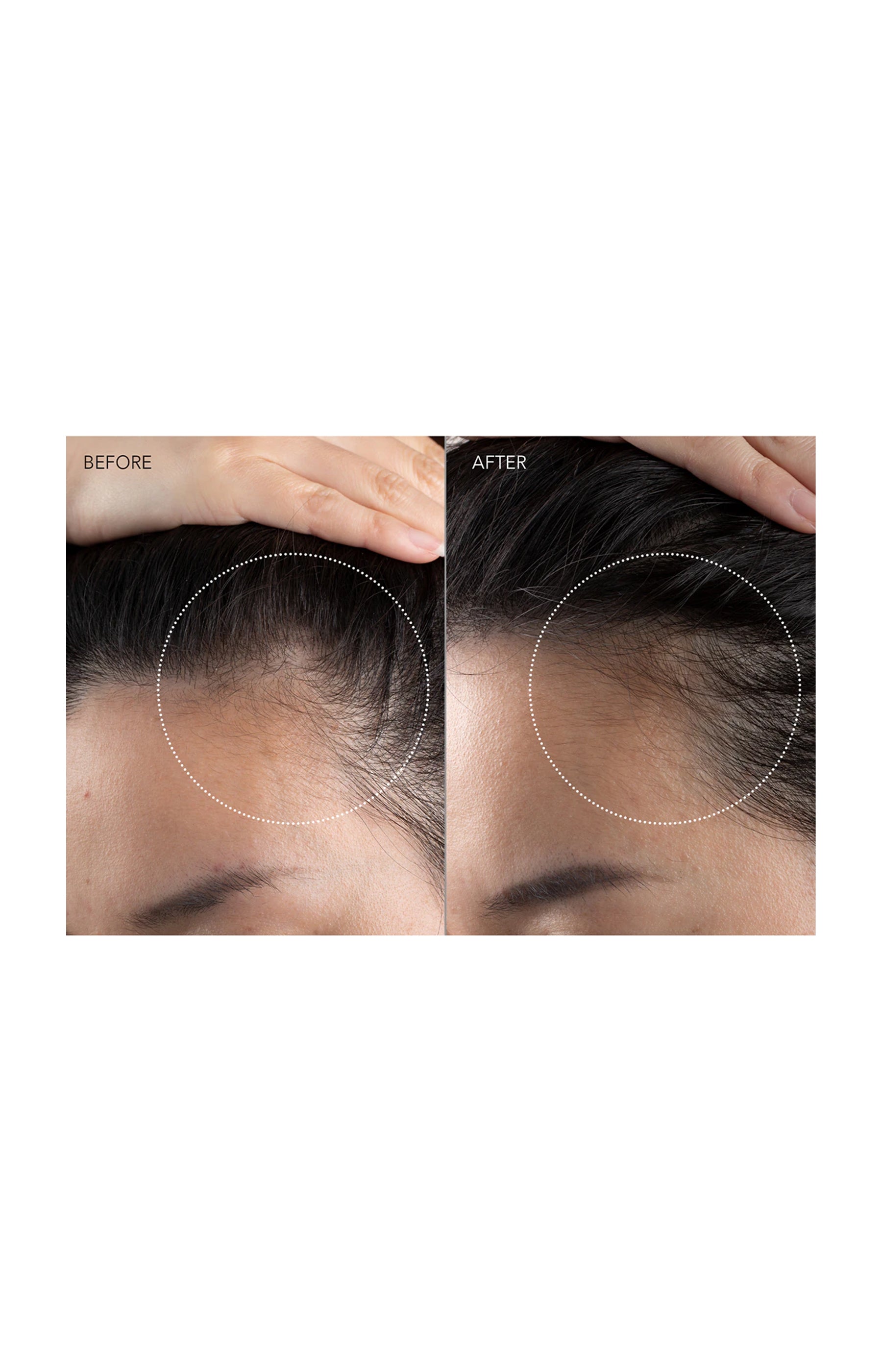 FAQ™ 301 - Hair Growth Stimulator Massager