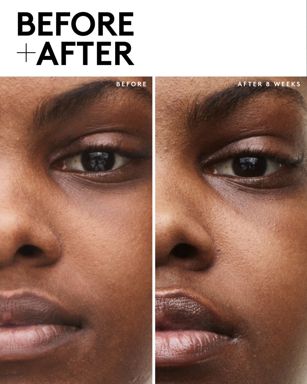 Fenty Skin Travel-Size Start'r Set with Mineral SPF: Dry Skin Edition