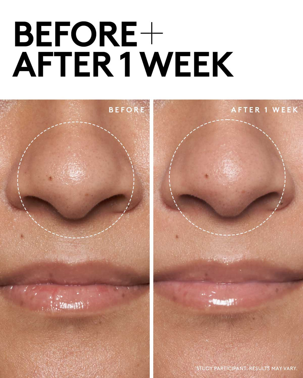 Detox N Tone Shine-Fighting Duo