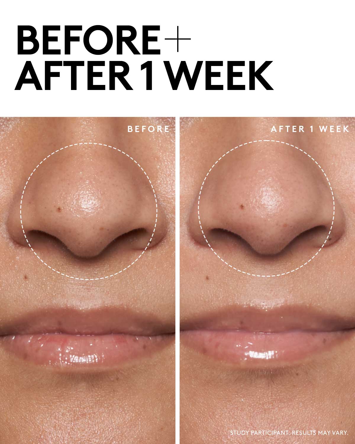 Detox N Tone Shine-Fighting Duo