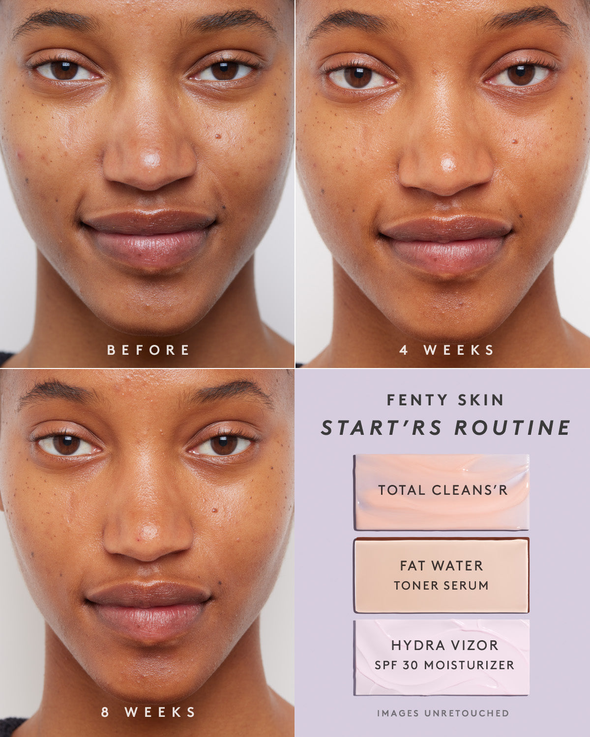 The Lil' Skincare Squad