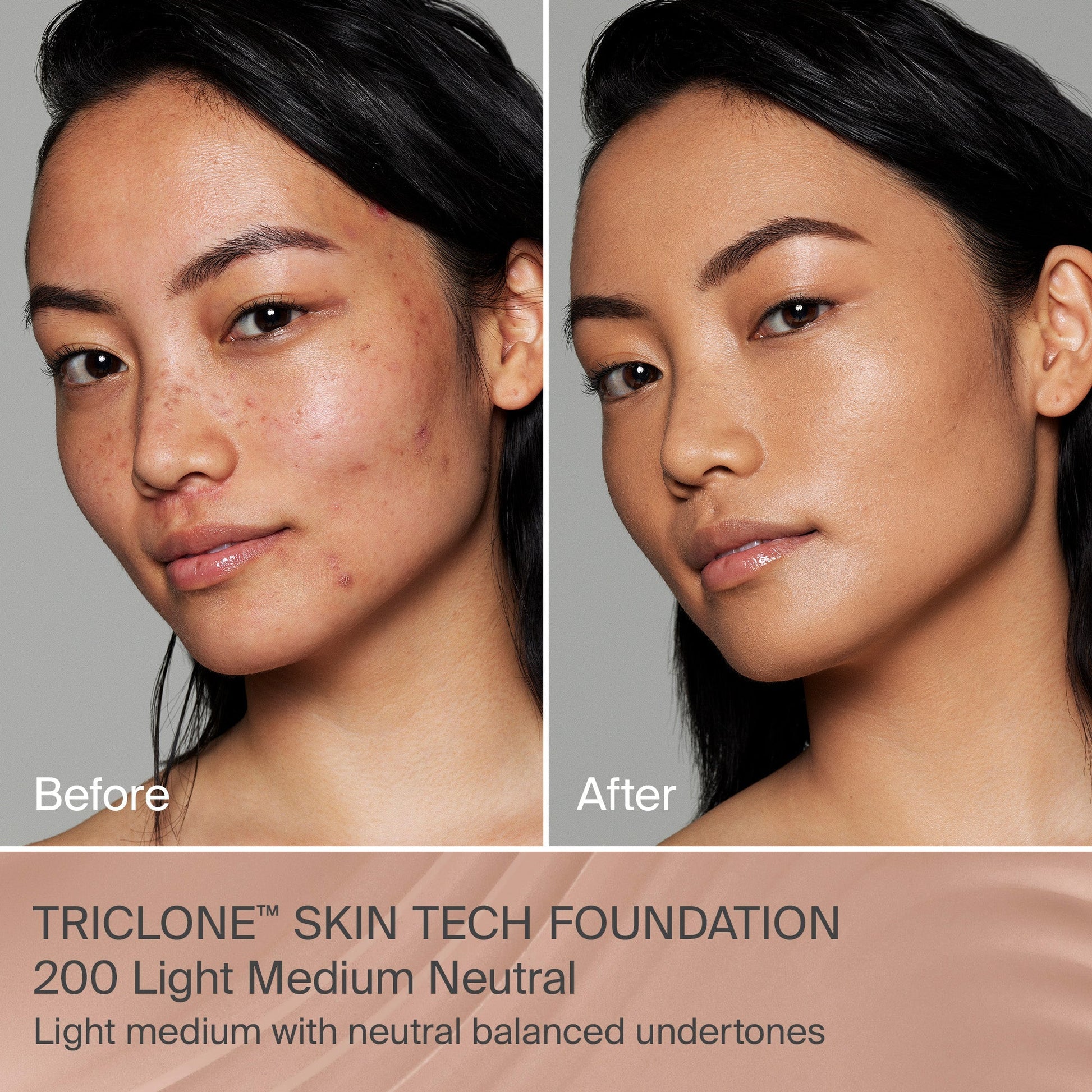 TRICLONE™ SKIN TECH MEDIUM COVERAGE FOUNDATION