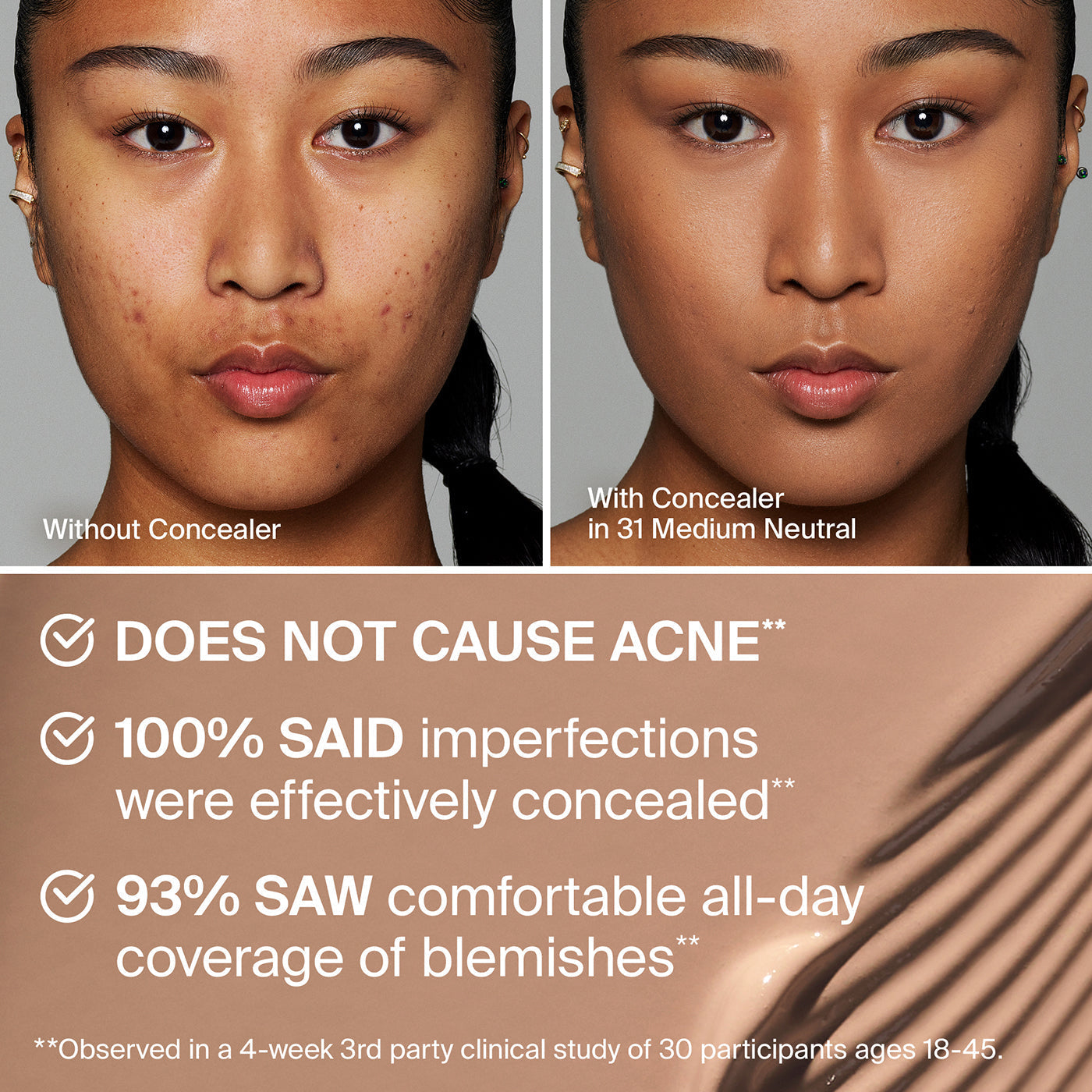 TRICLONE™ SKIN TECH CONCEALER