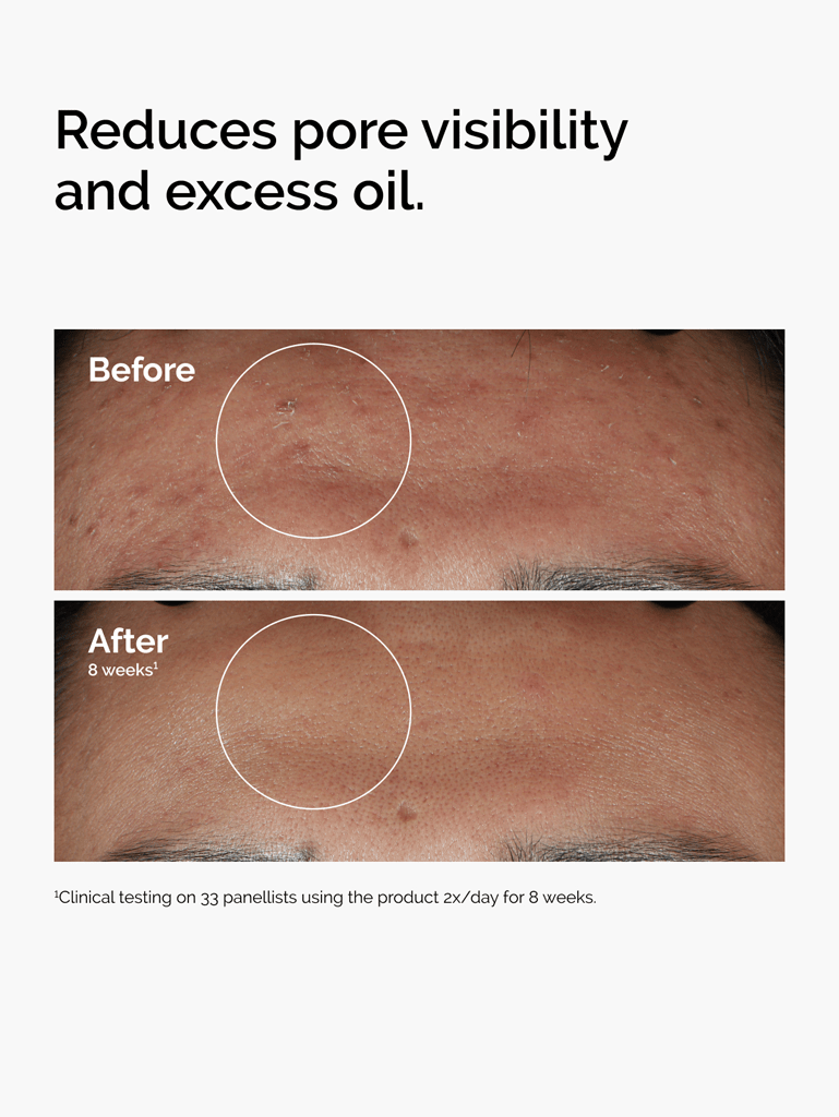 Niacinamide 10 % + Zinc 1 % – The Ordinary | 30 ml