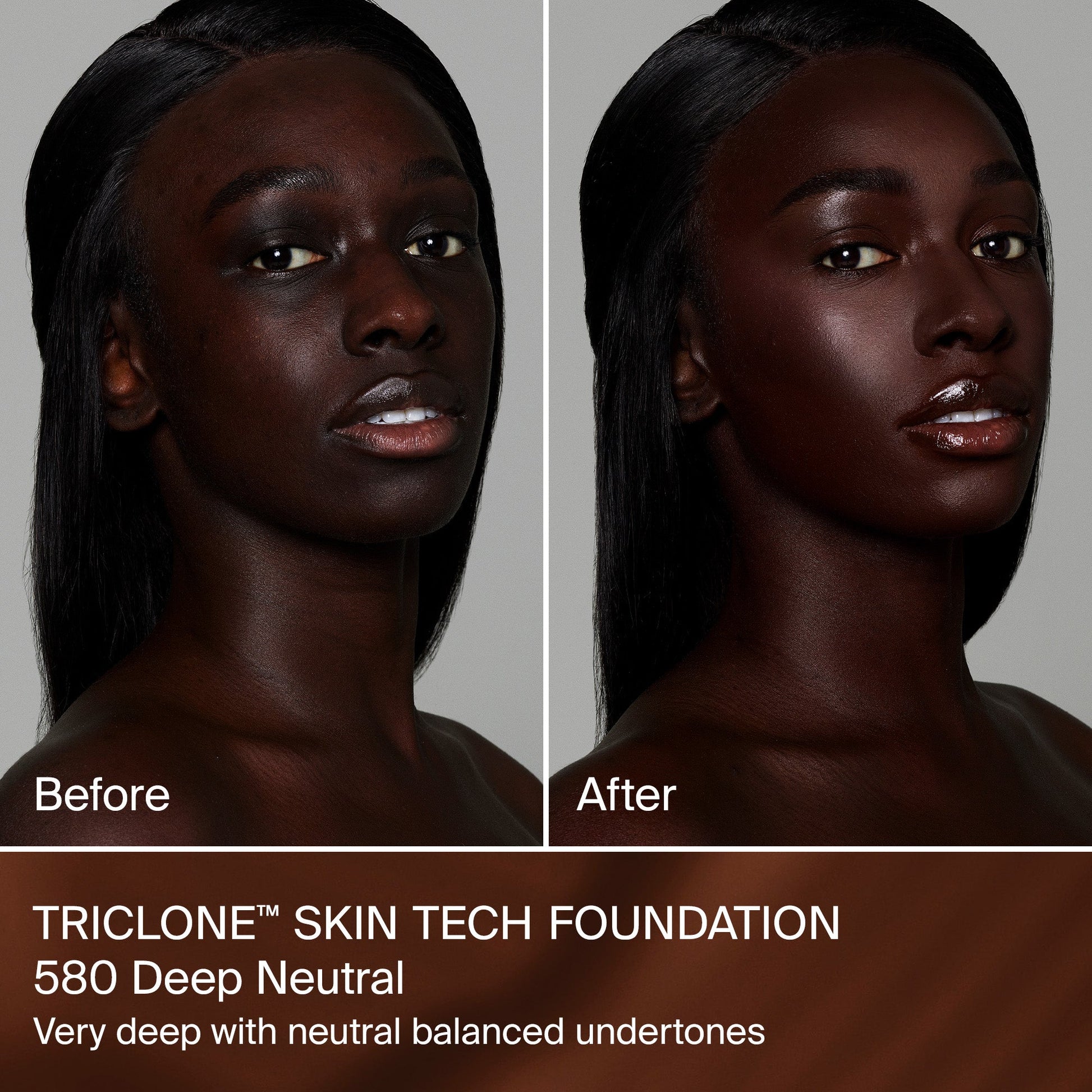 TRICLONE™ SKIN TECH MEDIUM COVERAGE FOUNDATION