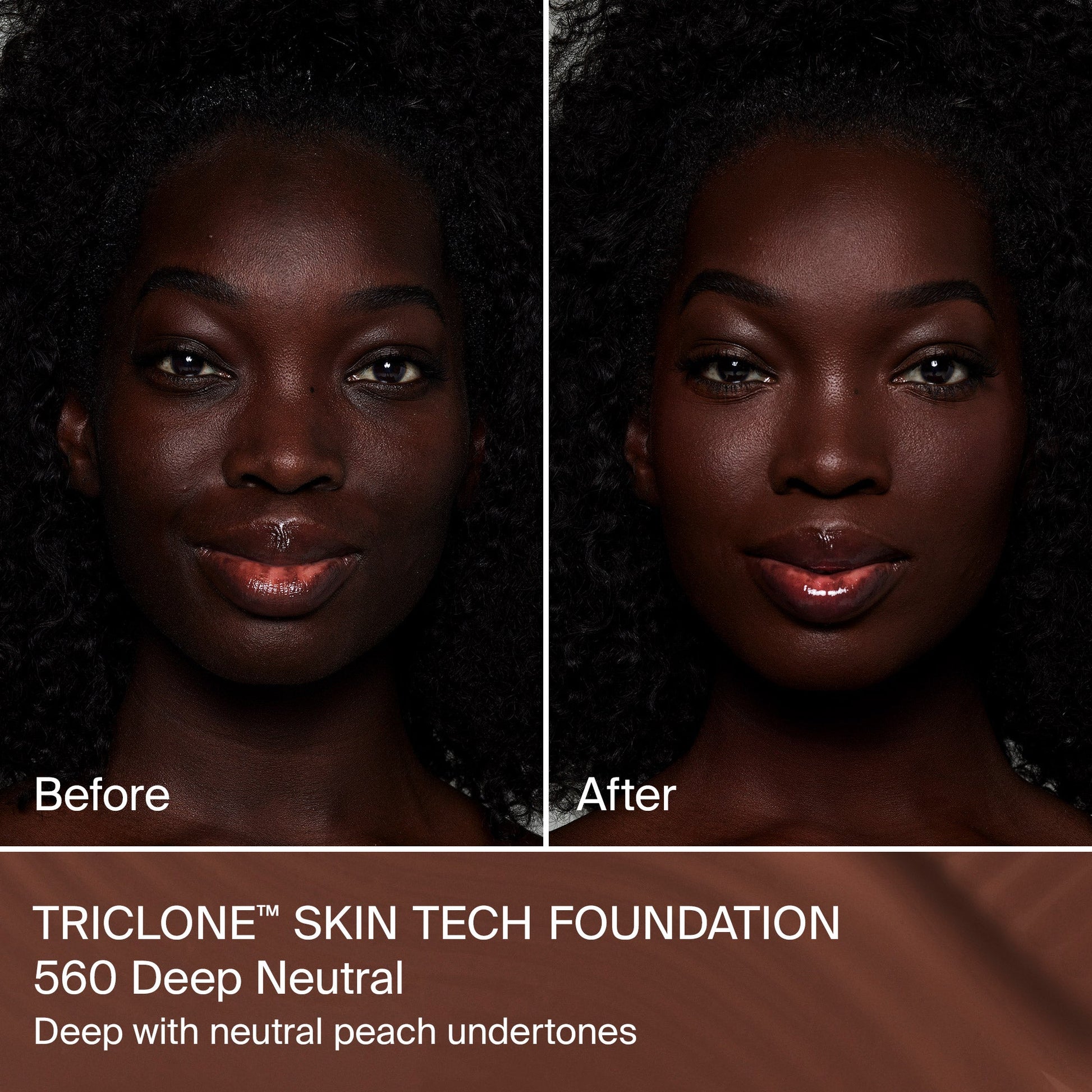 TRICLONE™ SKIN TECH MEDIUM COVERAGE FOUNDATION