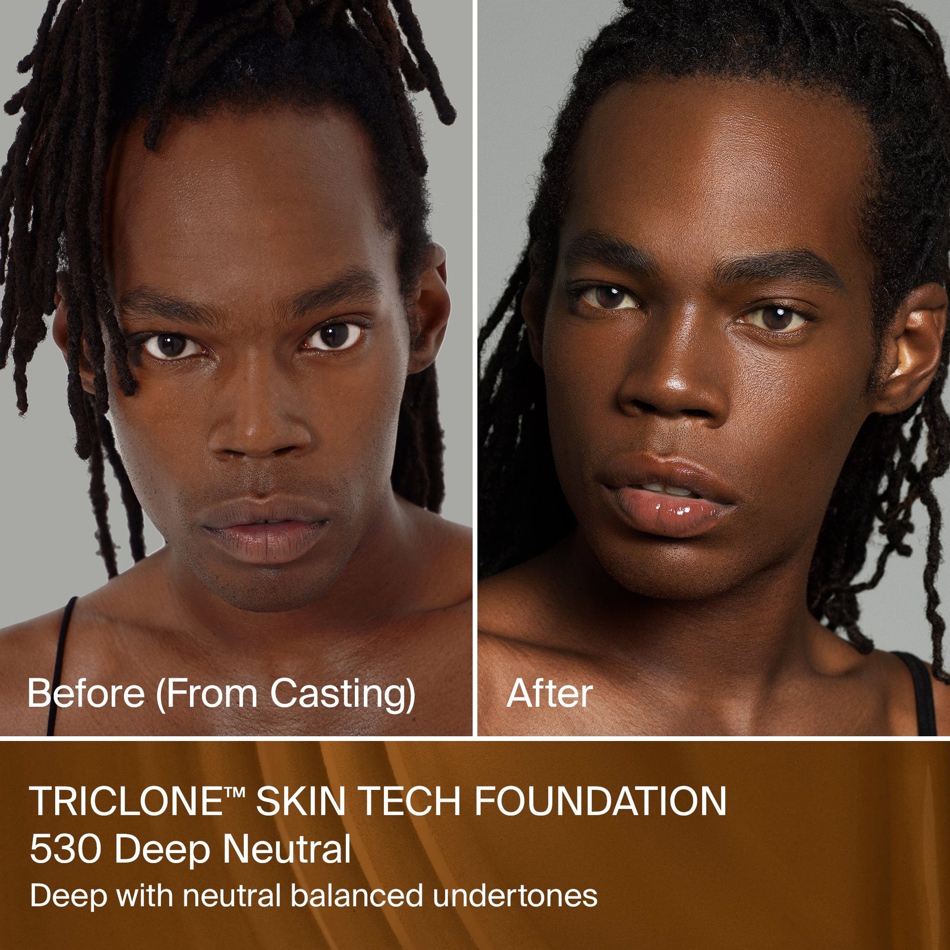 TRICLONE™ SKIN TECH MEDIUM COVERAGE FOUNDATION