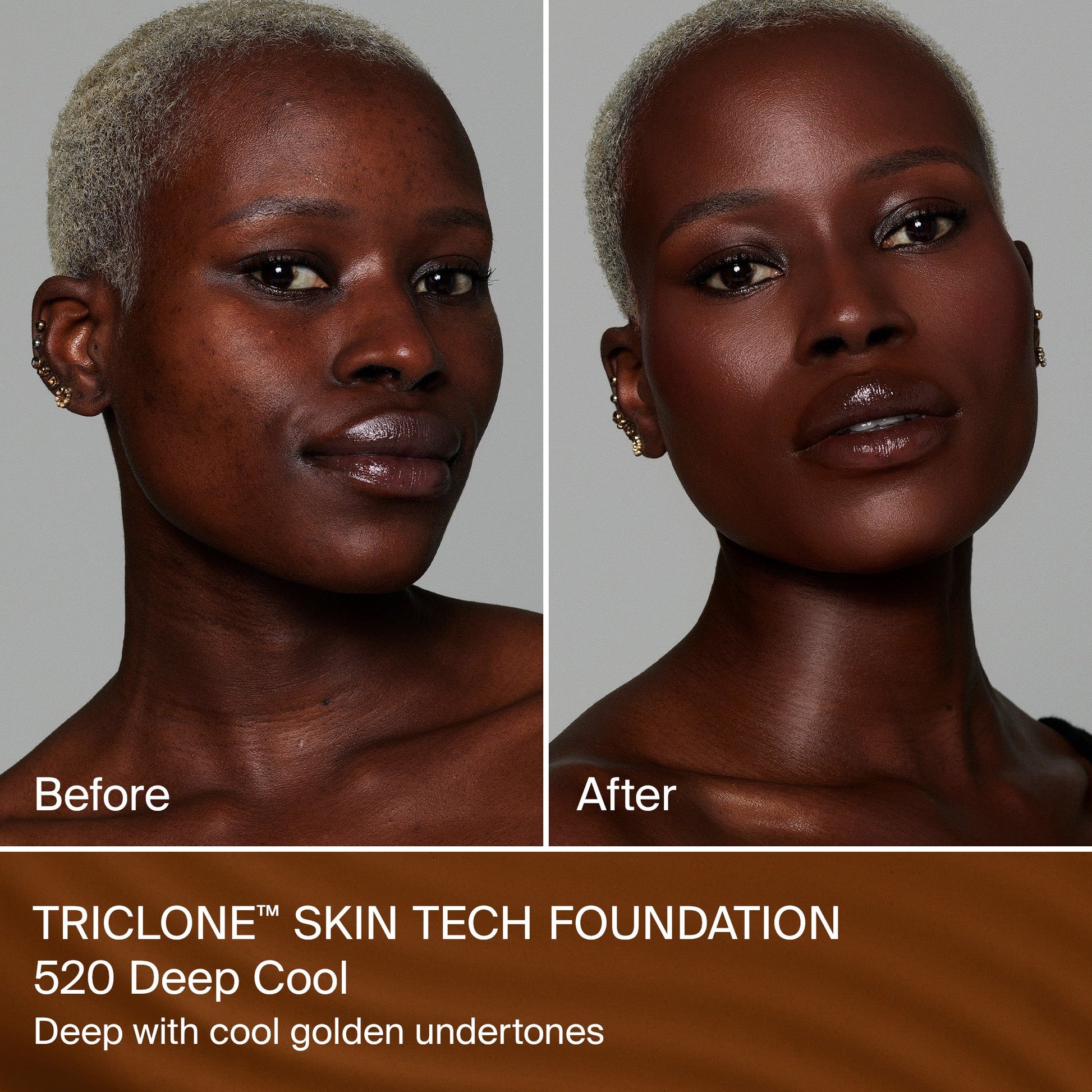 TRICLONE™ SKIN TECH MEDIUM COVERAGE FOUNDATION