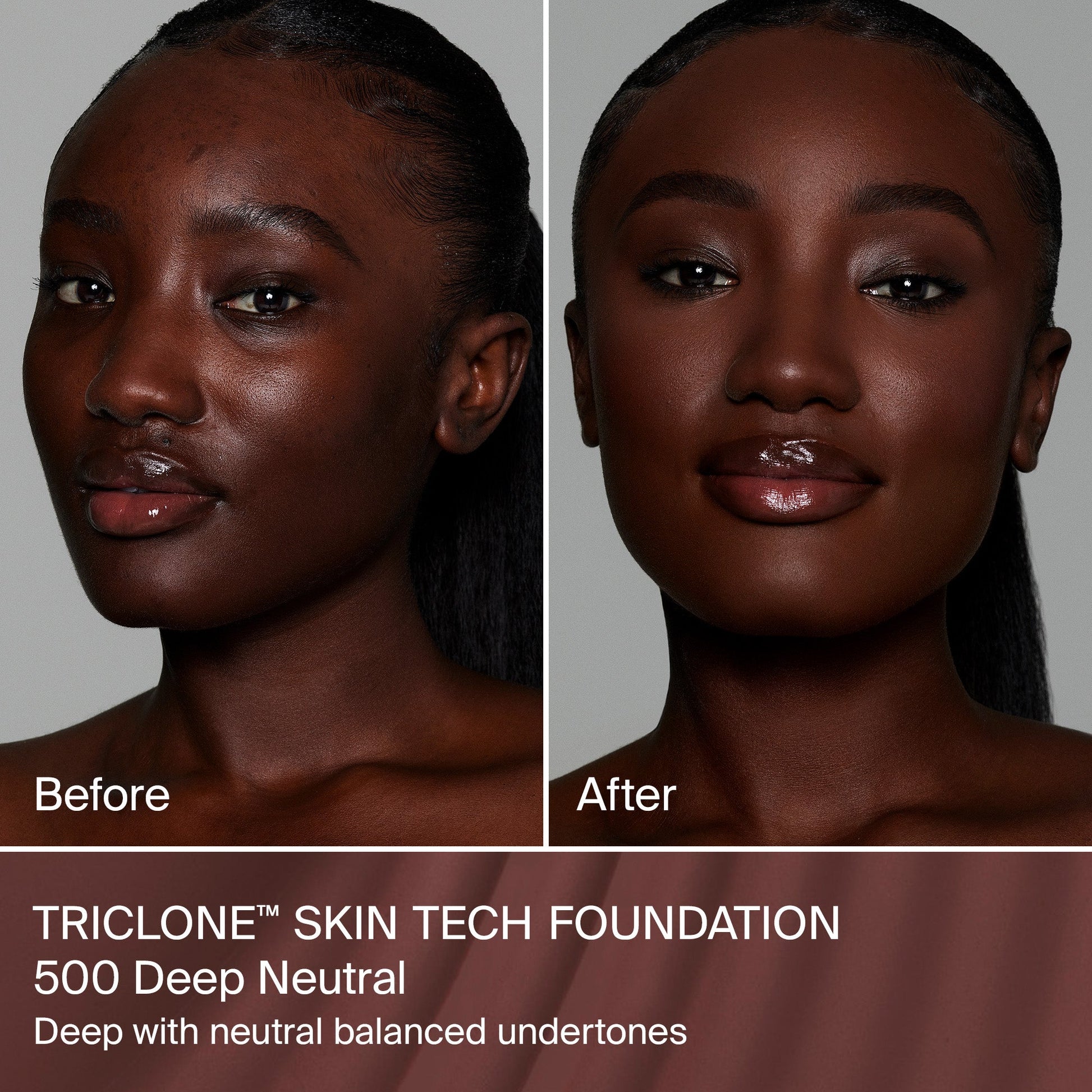 TRICLONE™ SKIN TECH MEDIUM COVERAGE FOUNDATION