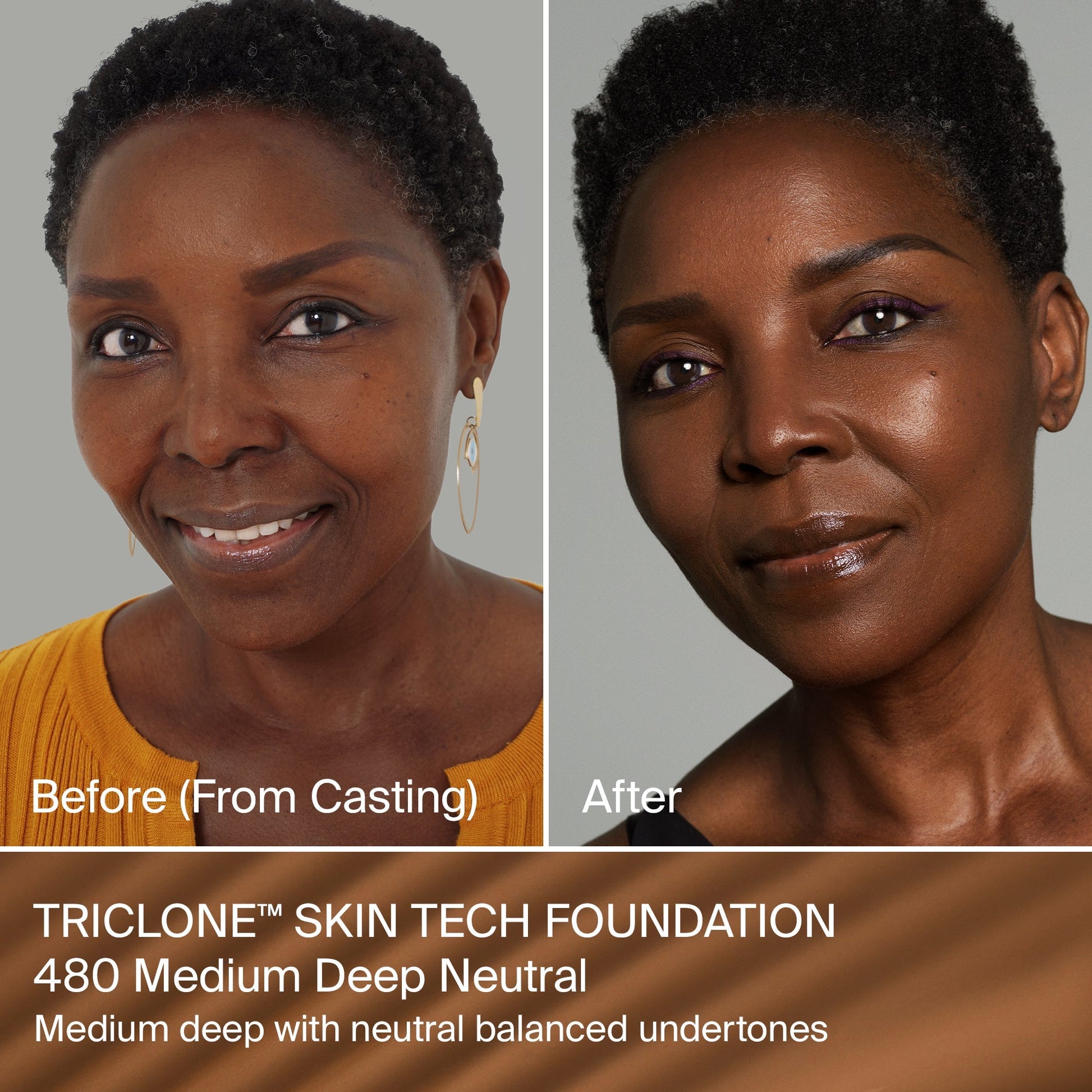 TRICLONE™ SKIN TECH MEDIUM COVERAGE FOUNDATION