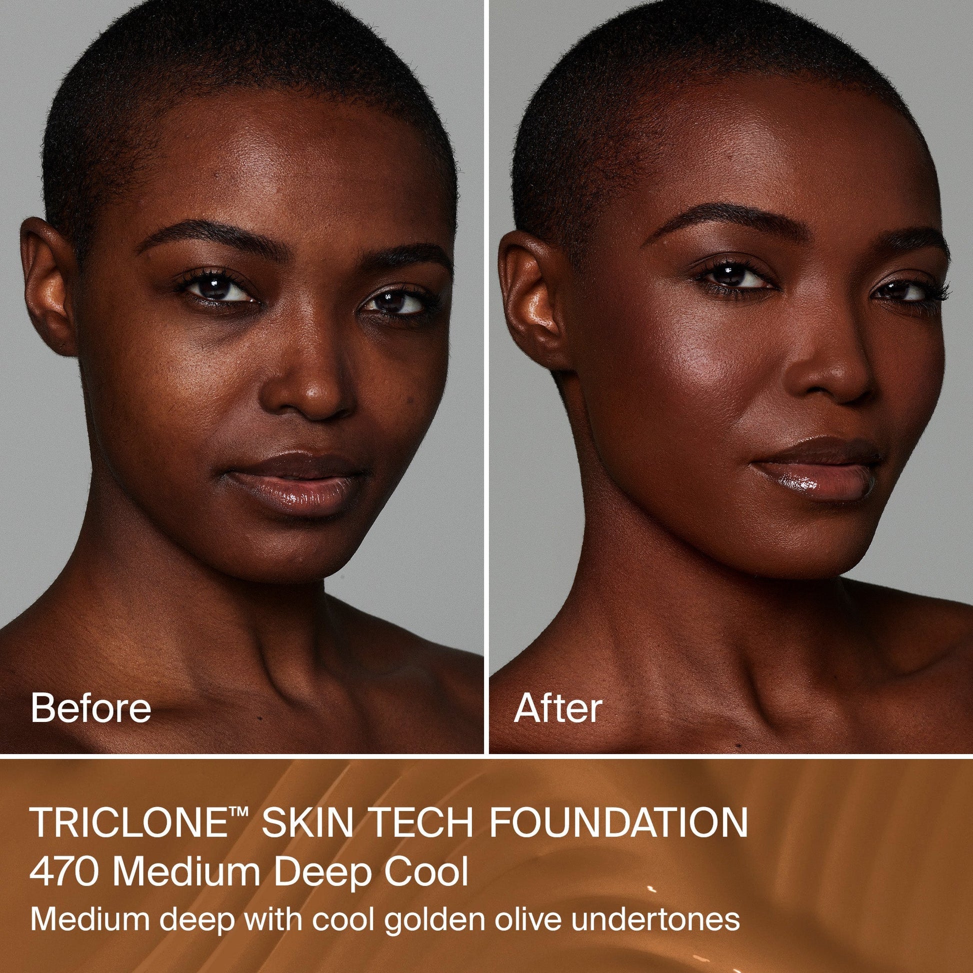 TRICLONE™ SKIN TECH MEDIUM COVERAGE FOUNDATION