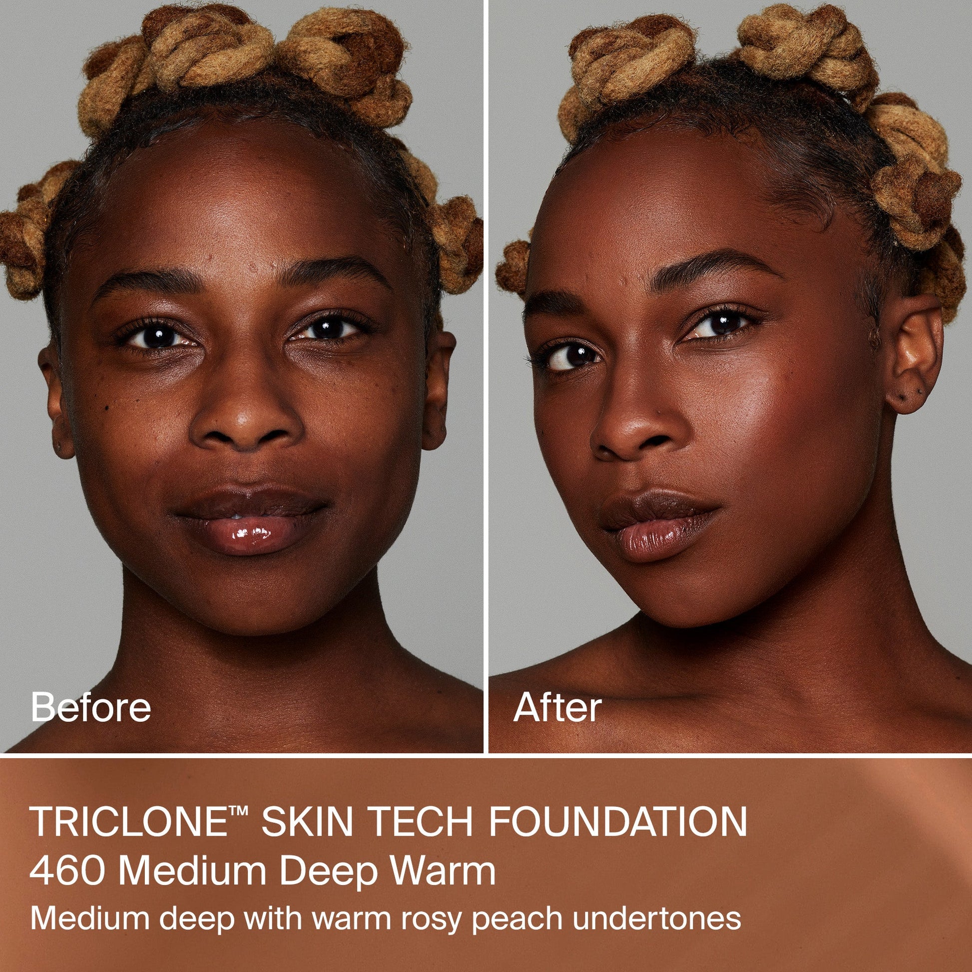 TRICLONE™ SKIN TECH MEDIUM COVERAGE FOUNDATION