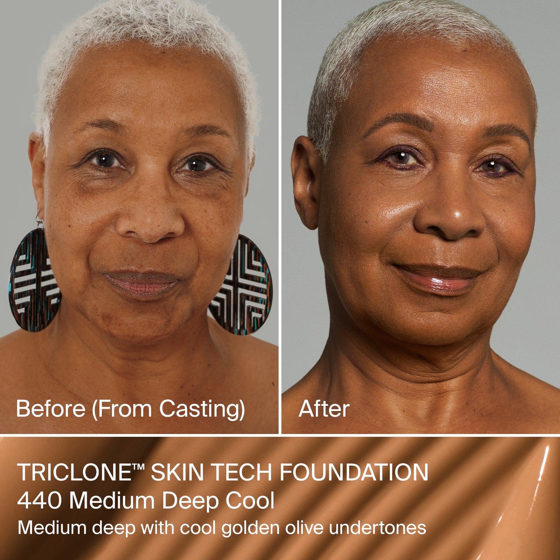 TRICLONE™ SKIN TECH MEDIUM COVERAGE FOUNDATION