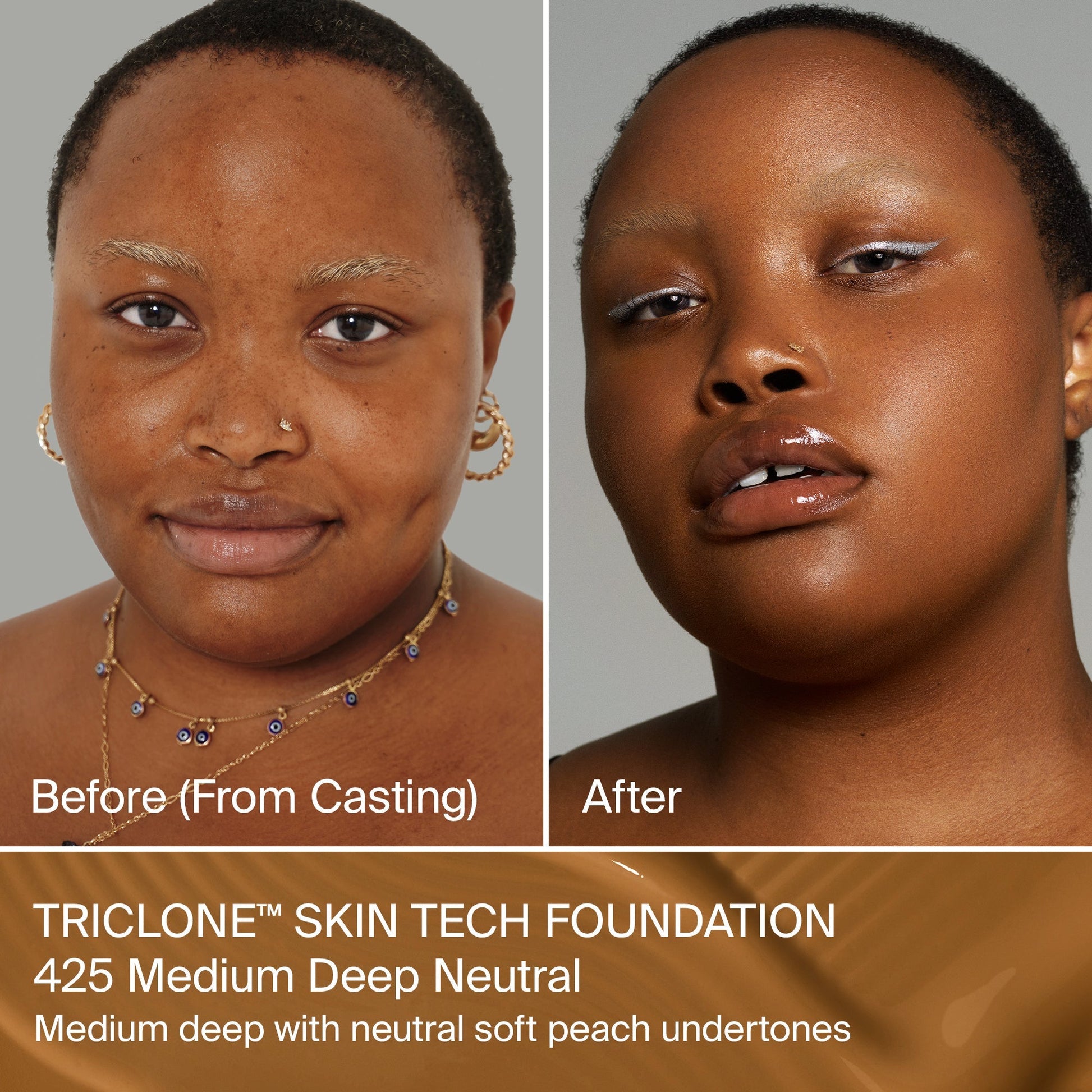 TRICLONE™ SKIN TECH MEDIUM COVERAGE FOUNDATION
