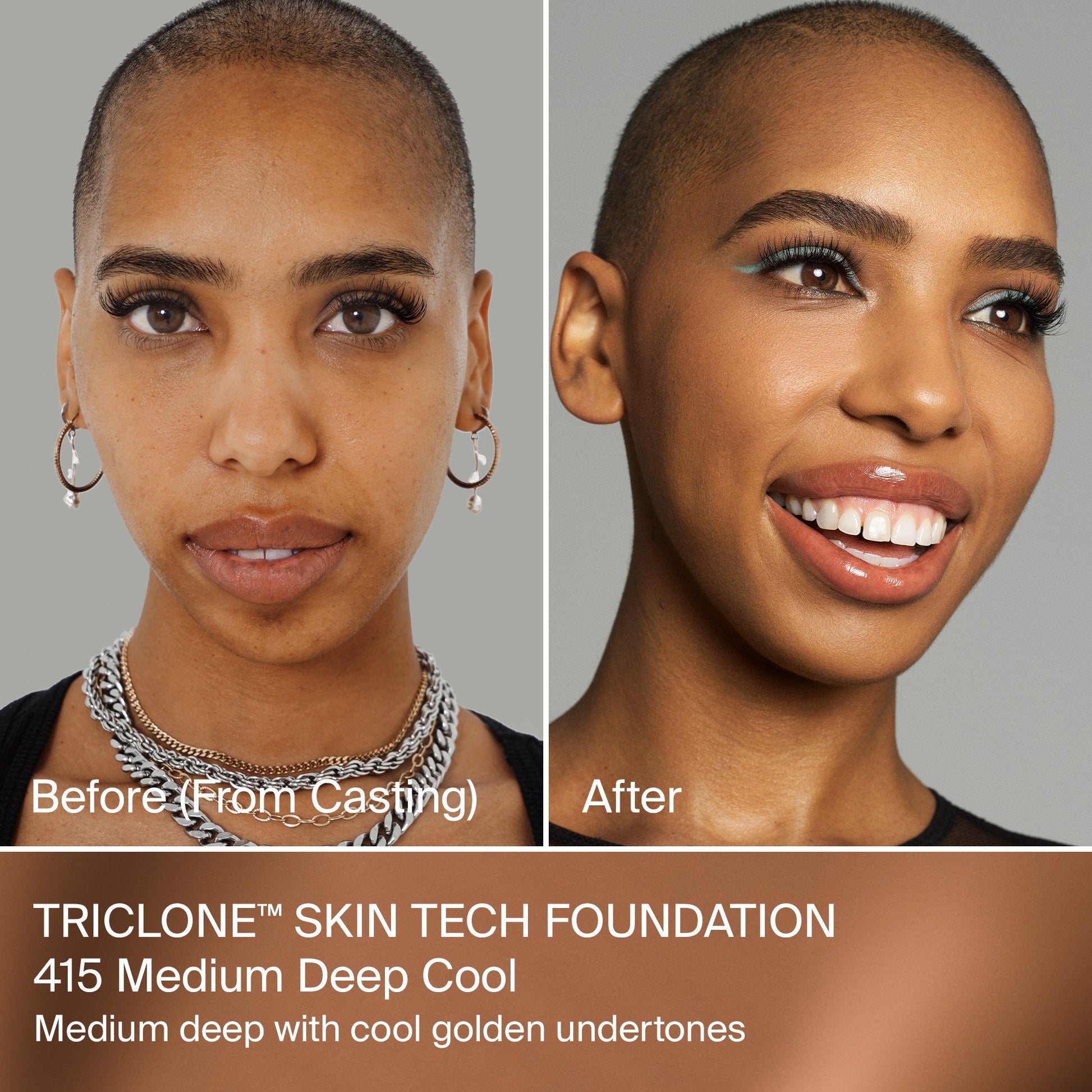 TRICLONE™ SKIN TECH MEDIUM COVERAGE FOUNDATION