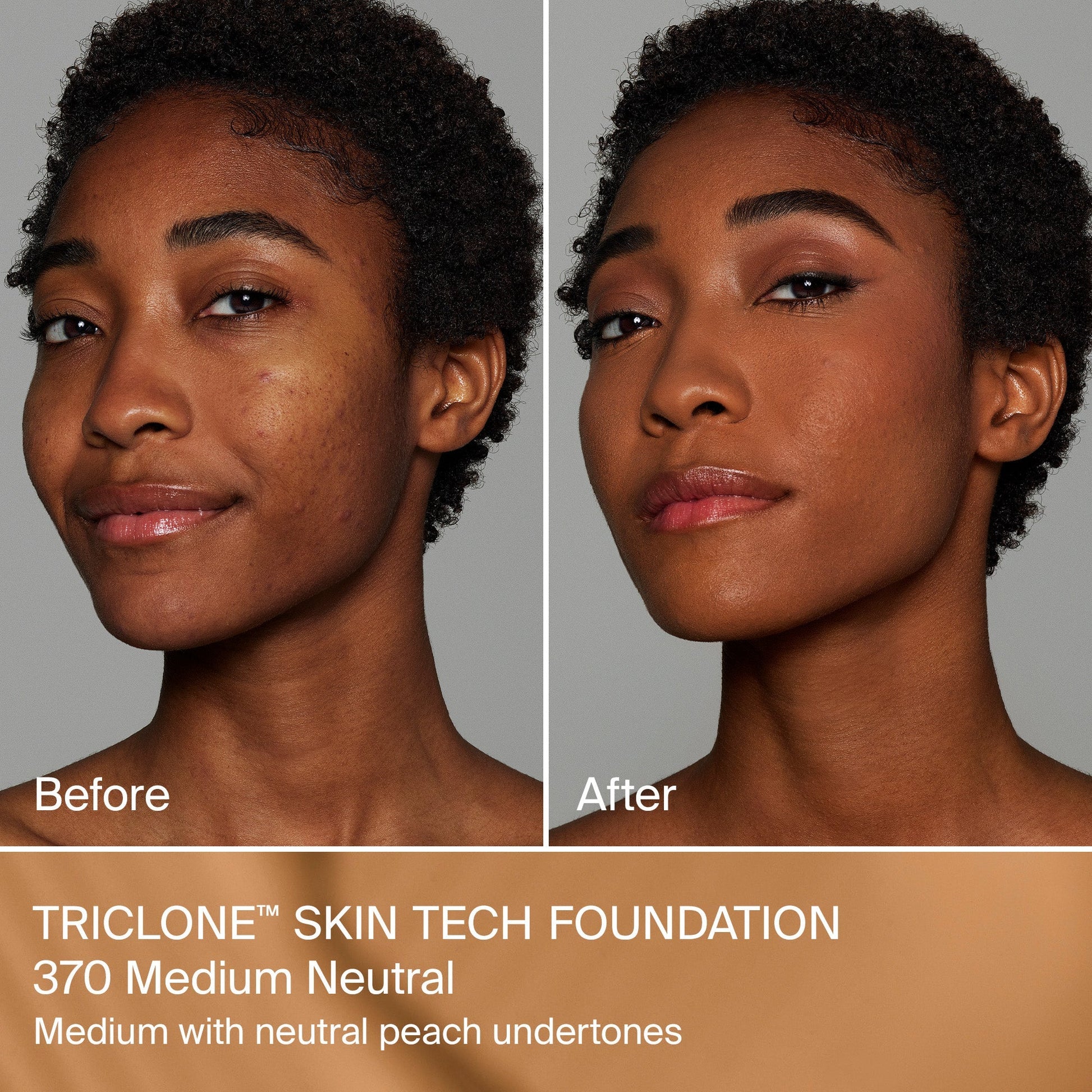 TRICLONE™ SKIN TECH MEDIUM COVERAGE FOUNDATION