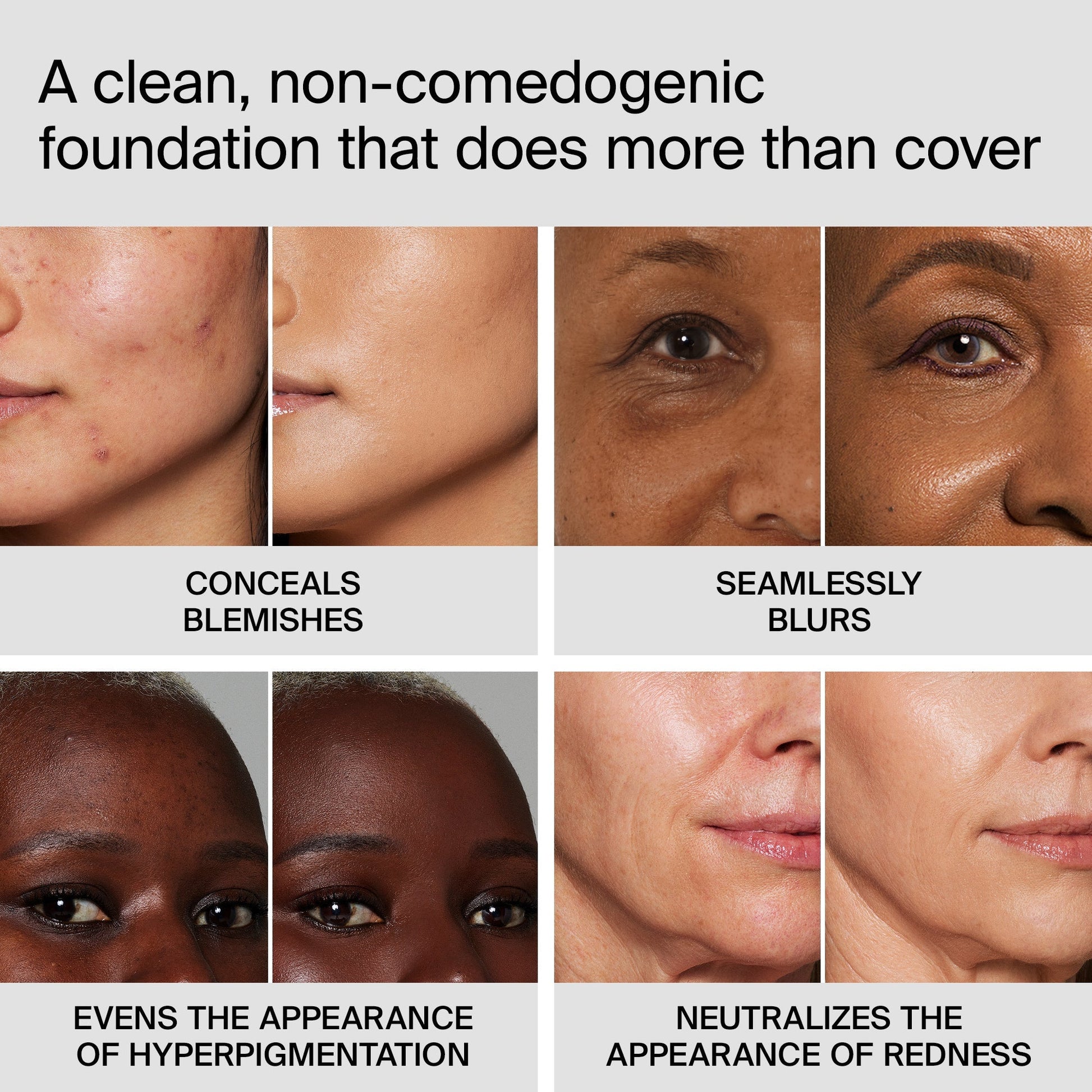 TRICLONE™ SKIN TECH MEDIUM COVERAGE FOUNDATION