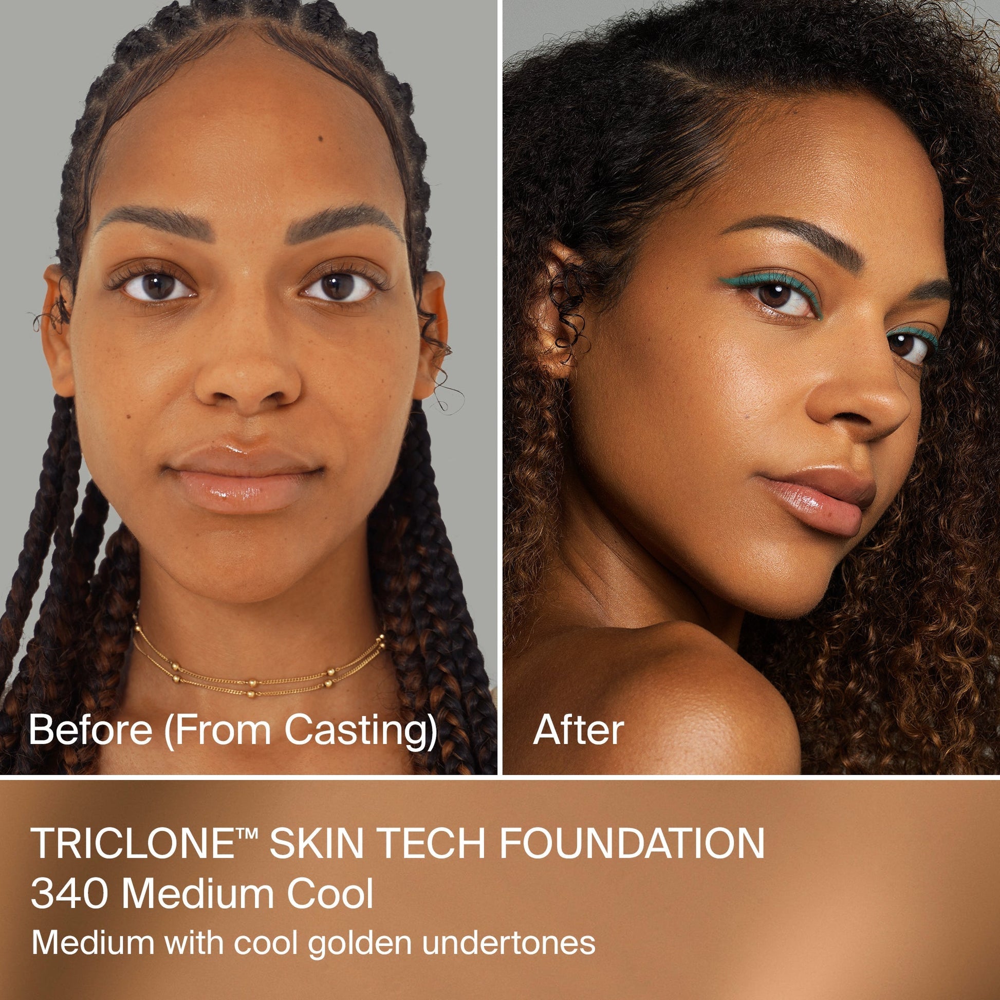 TRICLONE™ SKIN TECH MEDIUM COVERAGE FOUNDATION