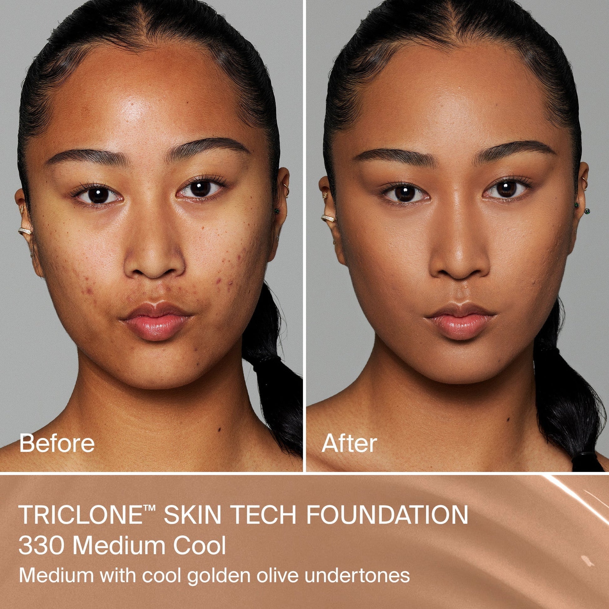 TRICLONE™ SKIN TECH MEDIUM COVERAGE FOUNDATION