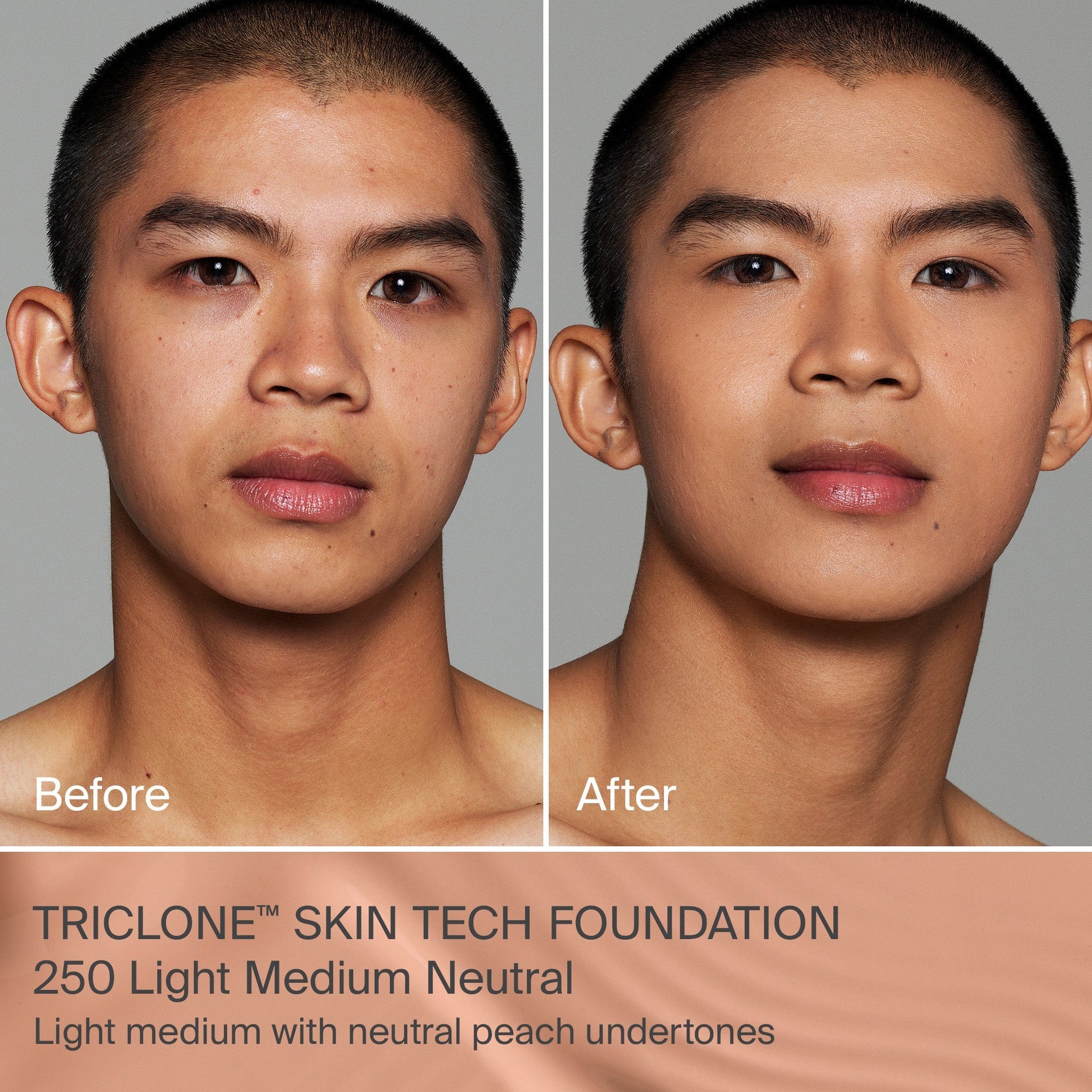 TRICLONE™ SKIN TECH MEDIUM COVERAGE FOUNDATION