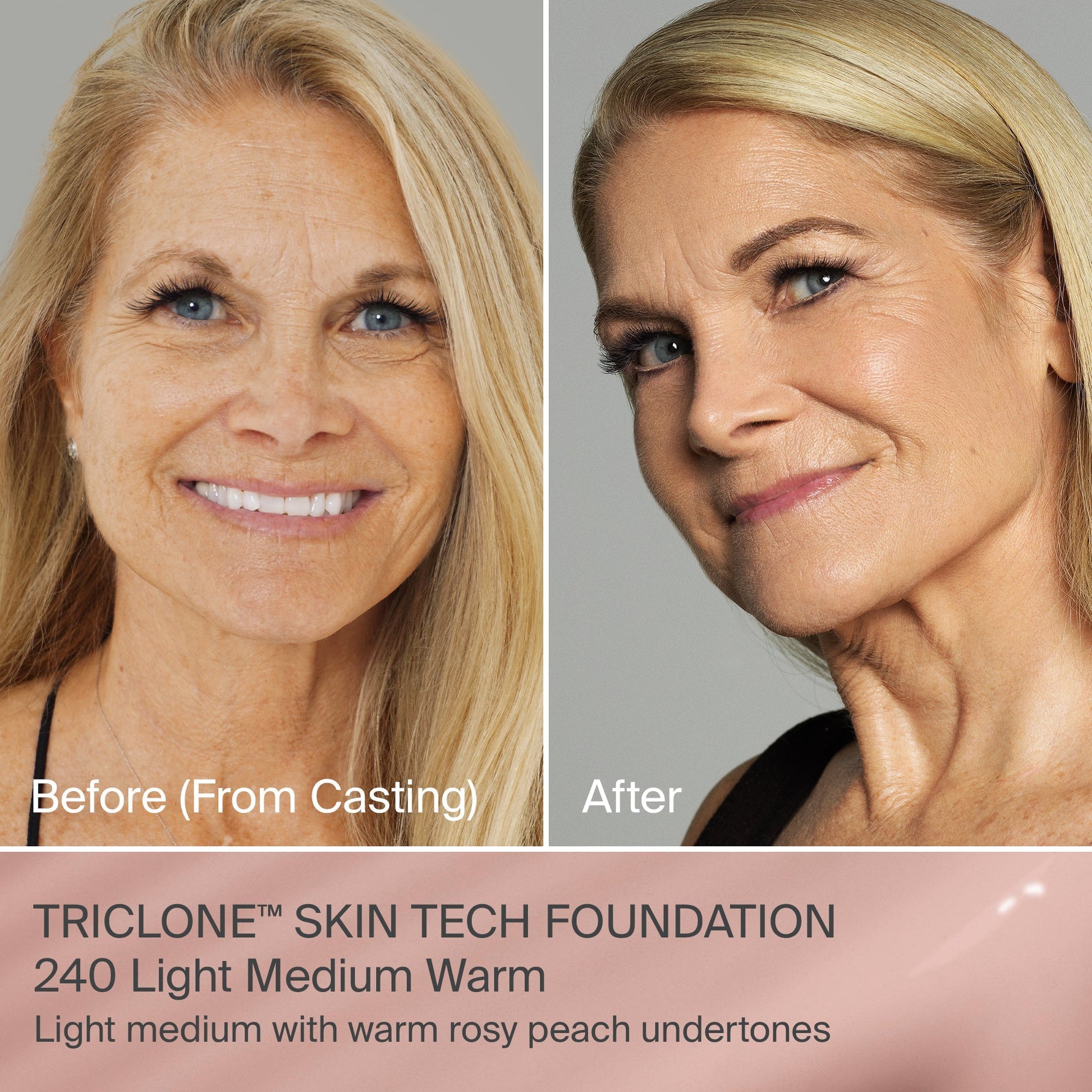 TRICLONE™ SKIN TECH MEDIUM COVERAGE FOUNDATION