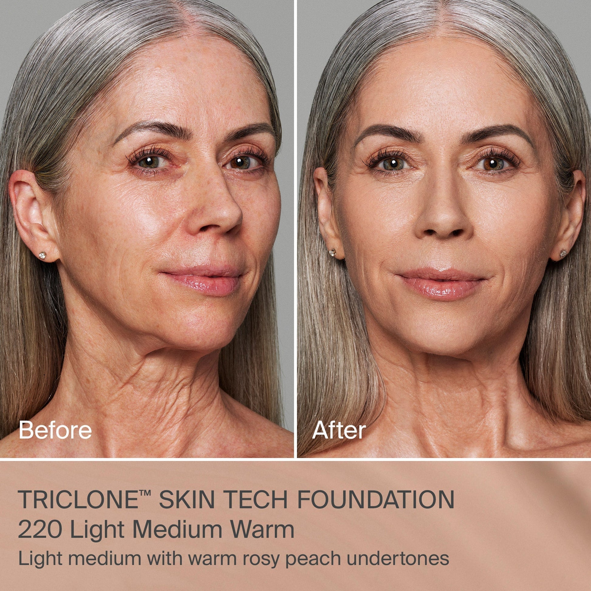 TRICLONE™ SKIN TECH MEDIUM COVERAGE FOUNDATION