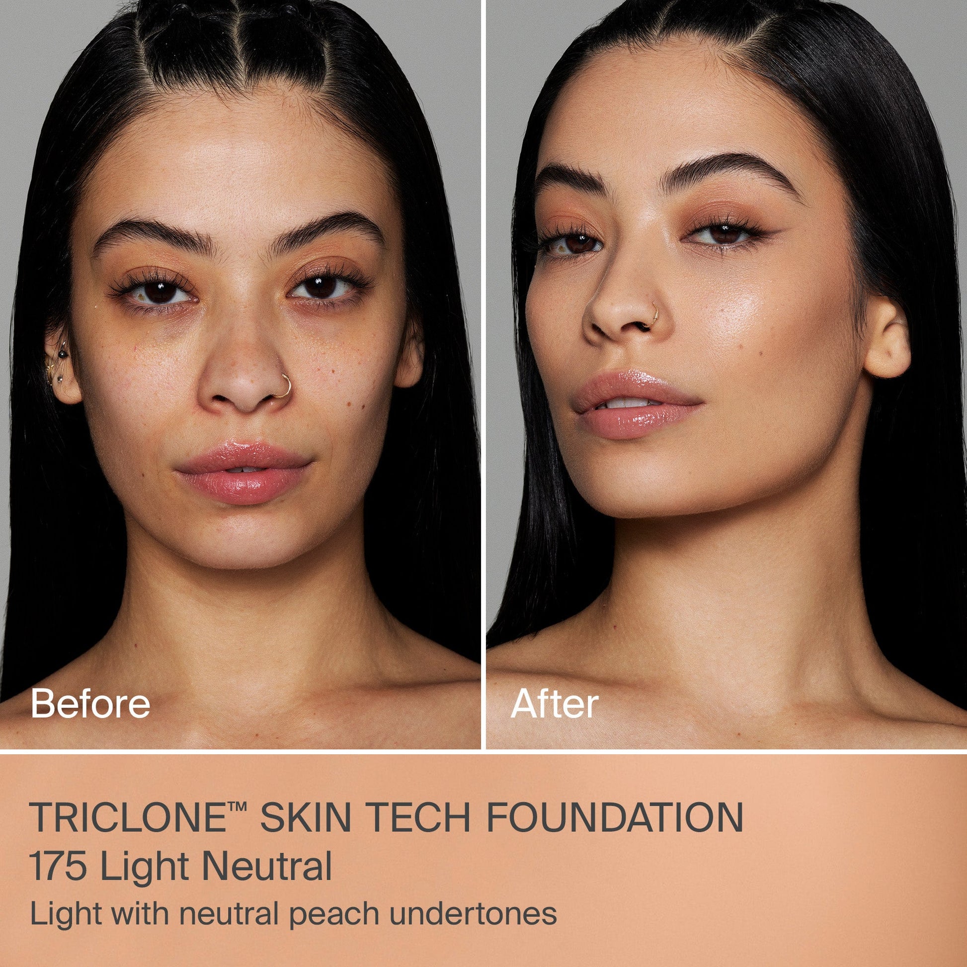 TRICLONE™ SKIN TECH MEDIUM COVERAGE FOUNDATION