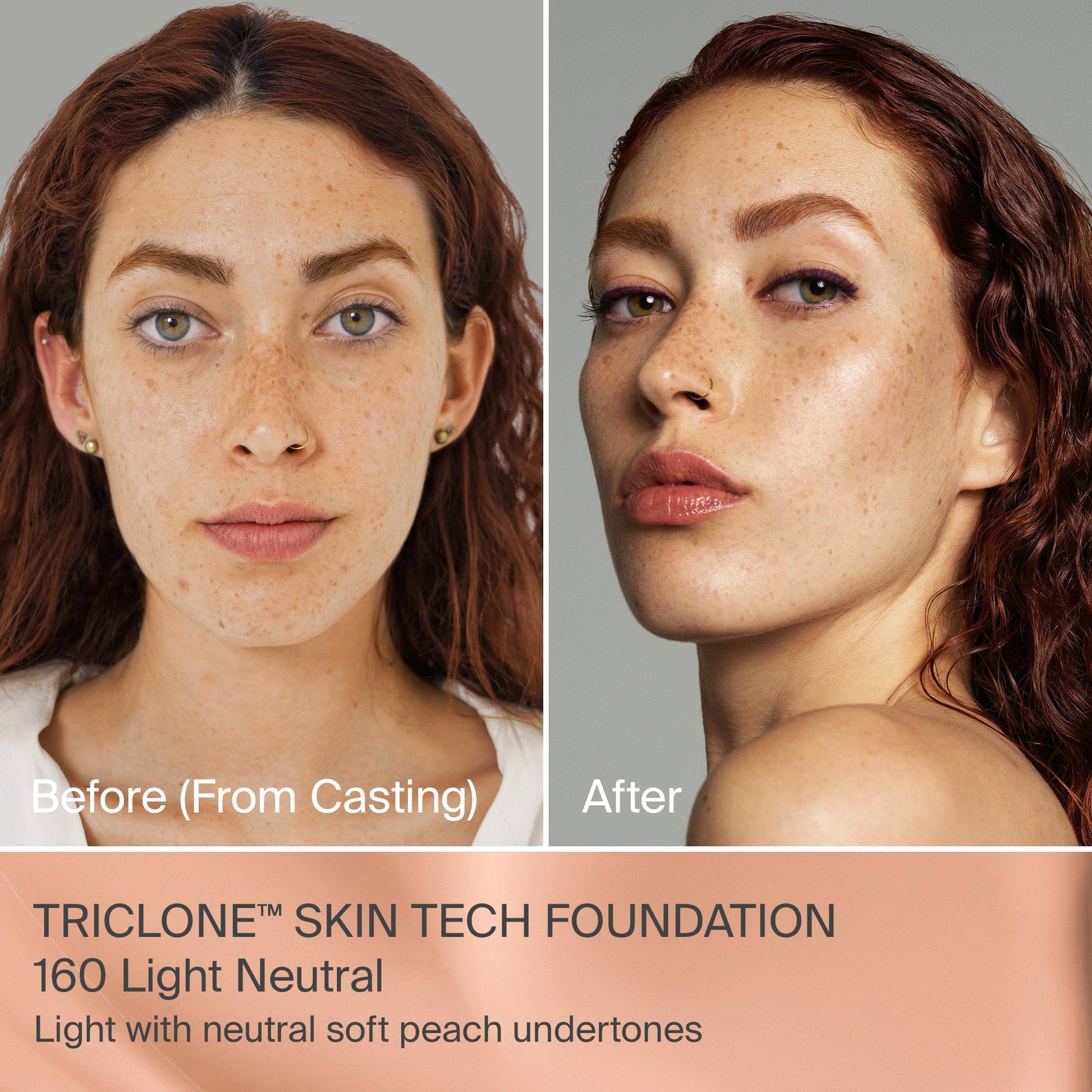 TRICLONE™ SKIN TECH MEDIUM COVERAGE FOUNDATION