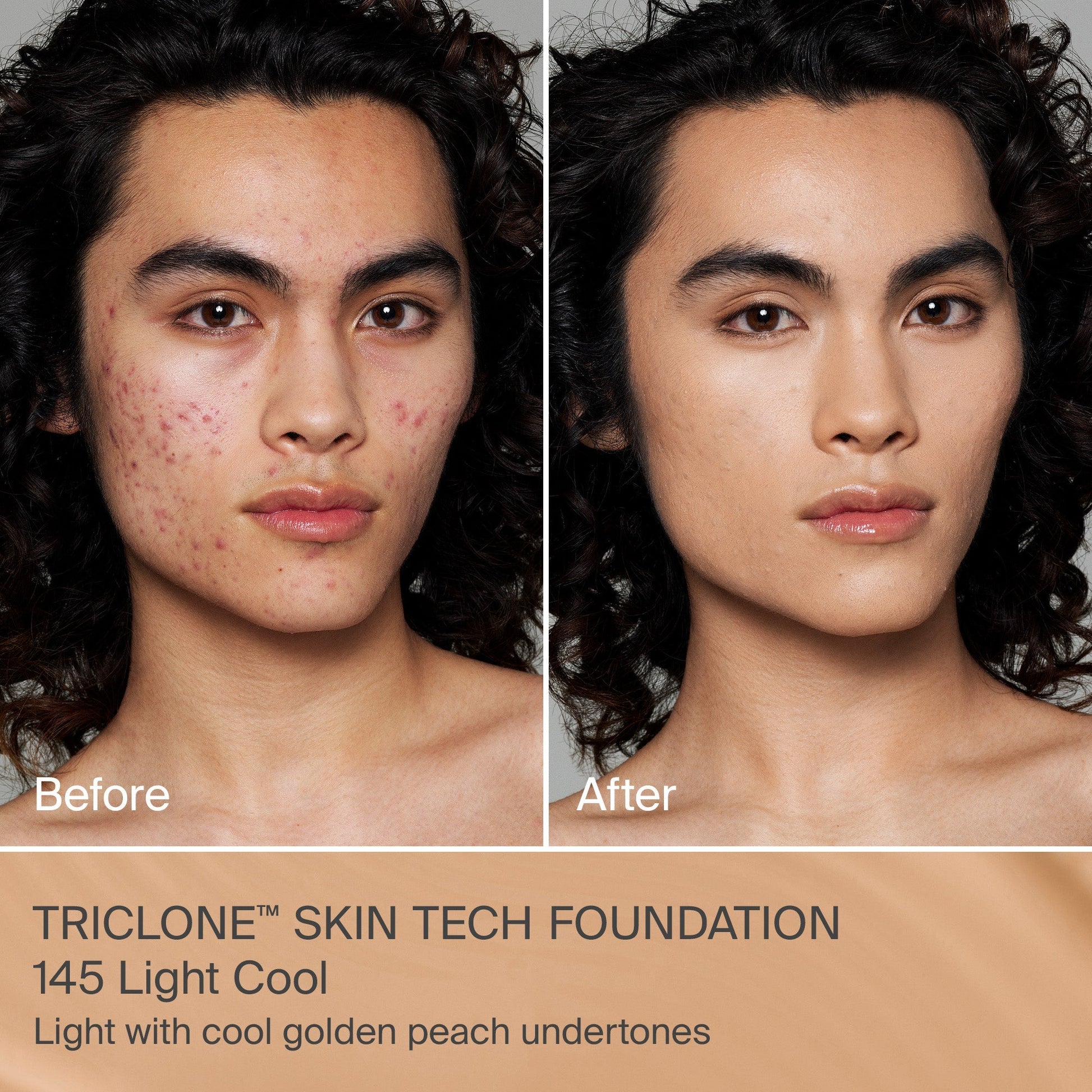 TRICLONE™ SKIN TECH MEDIUM COVERAGE FOUNDATION
