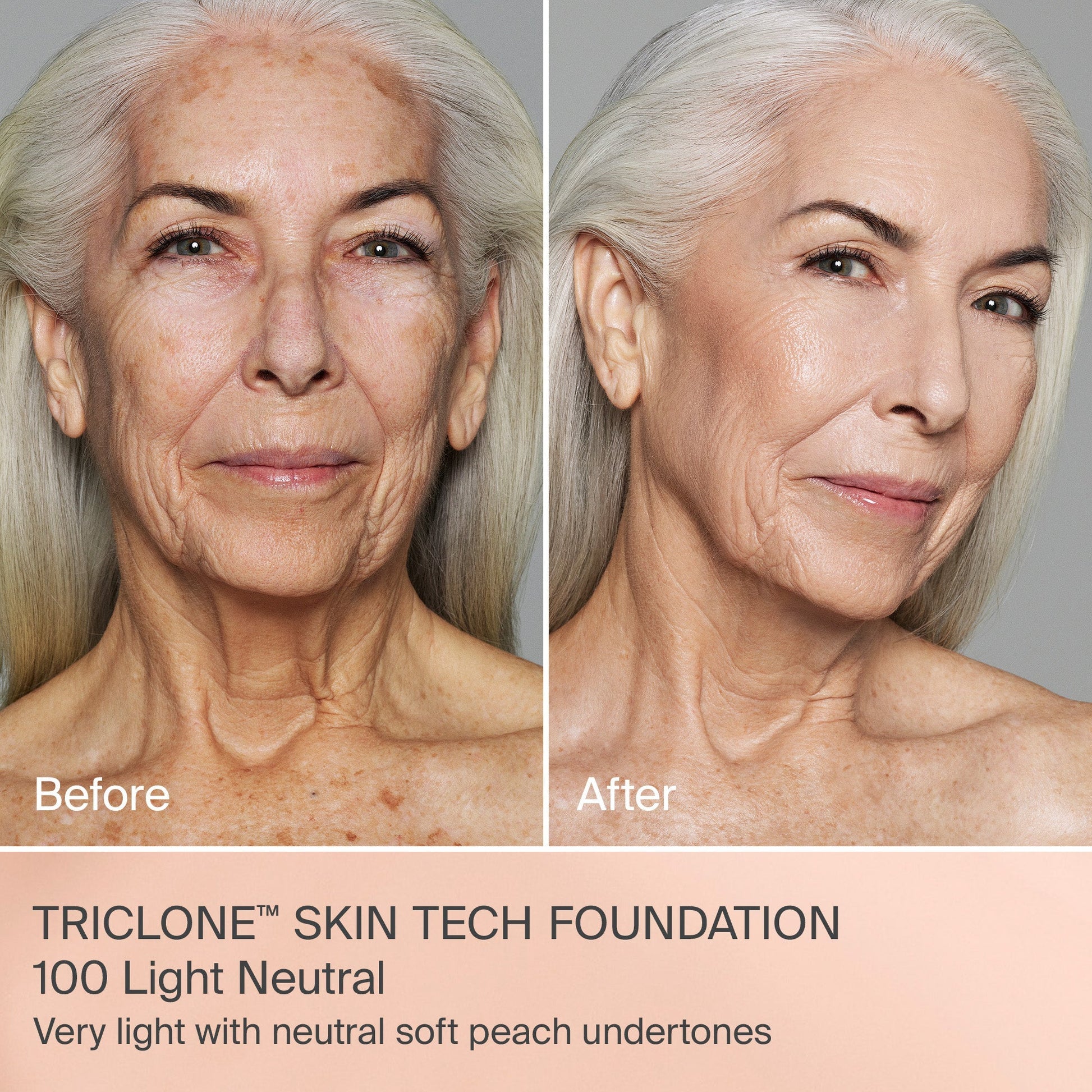 TRICLONE™ SKIN TECH MEDIUM COVERAGE FOUNDATION