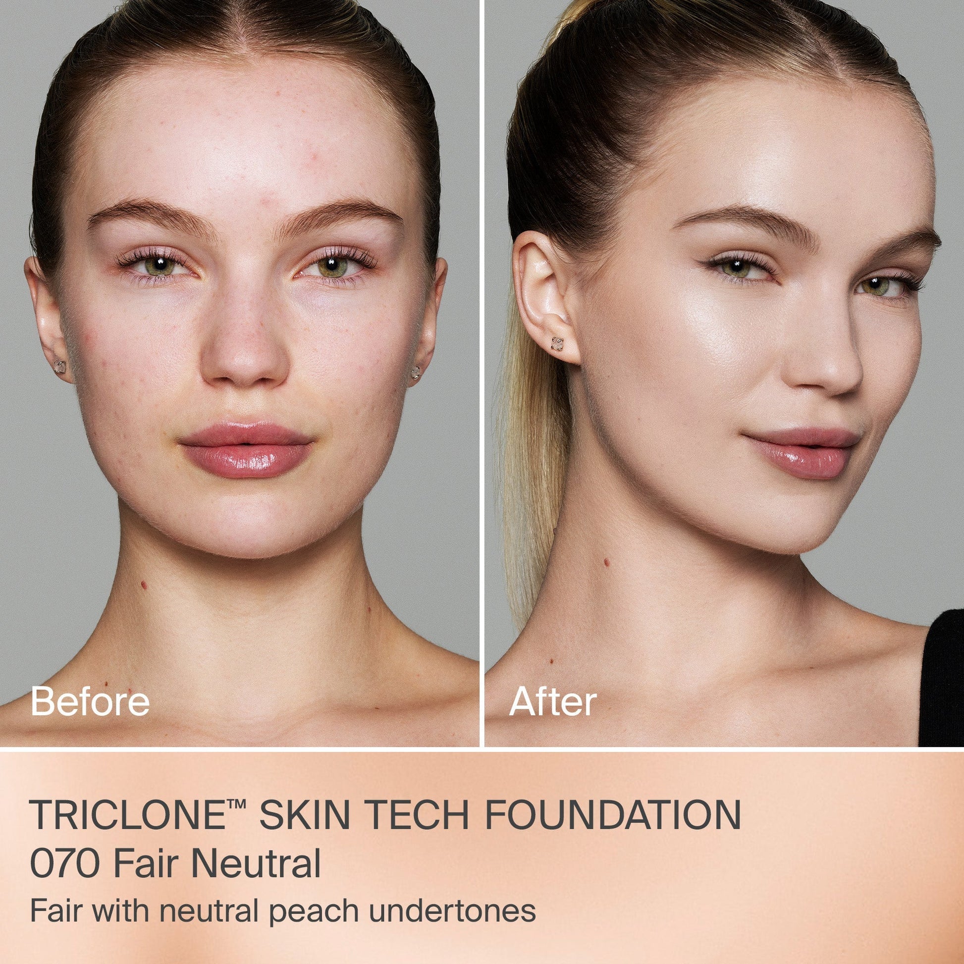 TRICLONE™ SKIN TECH MEDIUM COVERAGE FOUNDATION