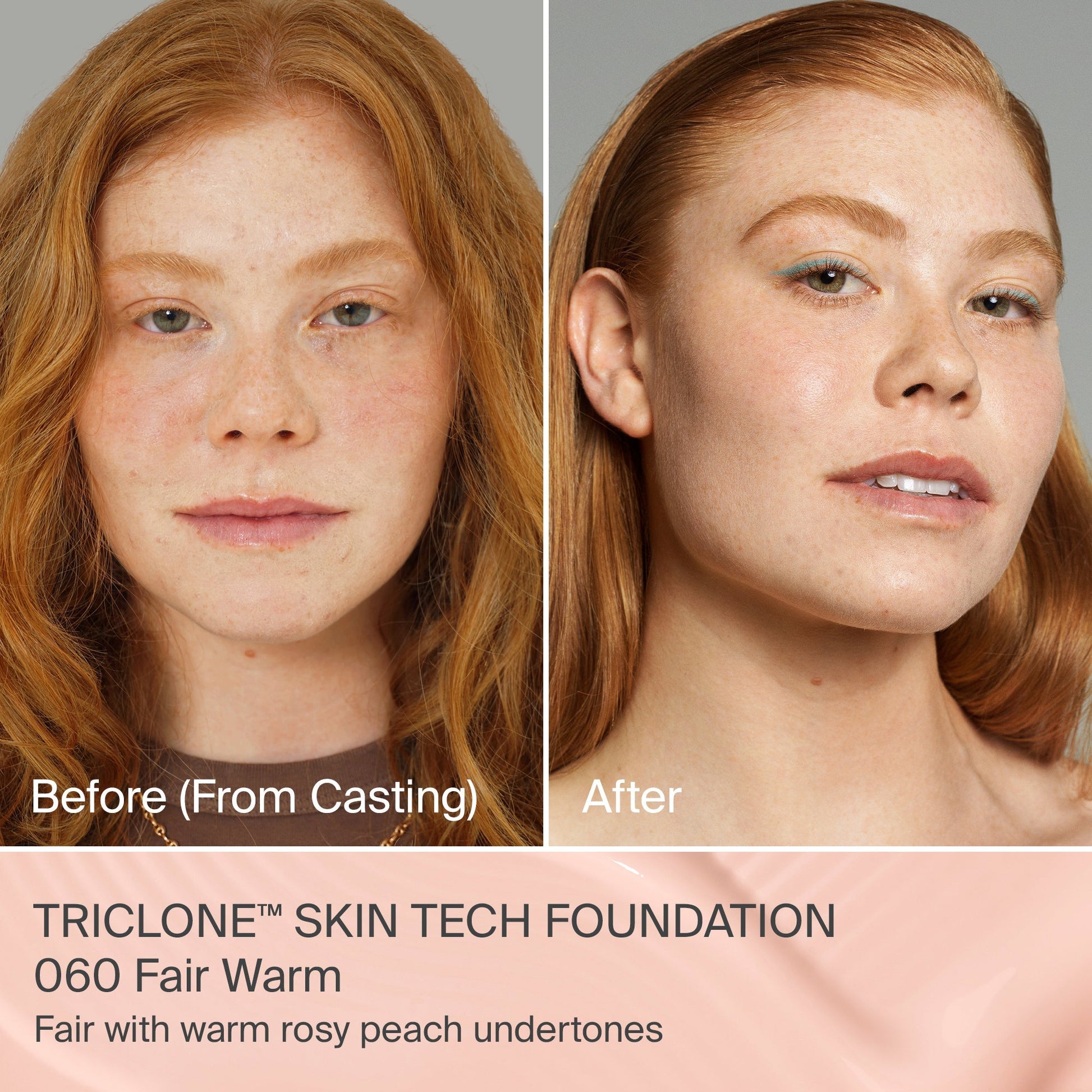 TRICLONE™ SKIN TECH MEDIUM COVERAGE FOUNDATION