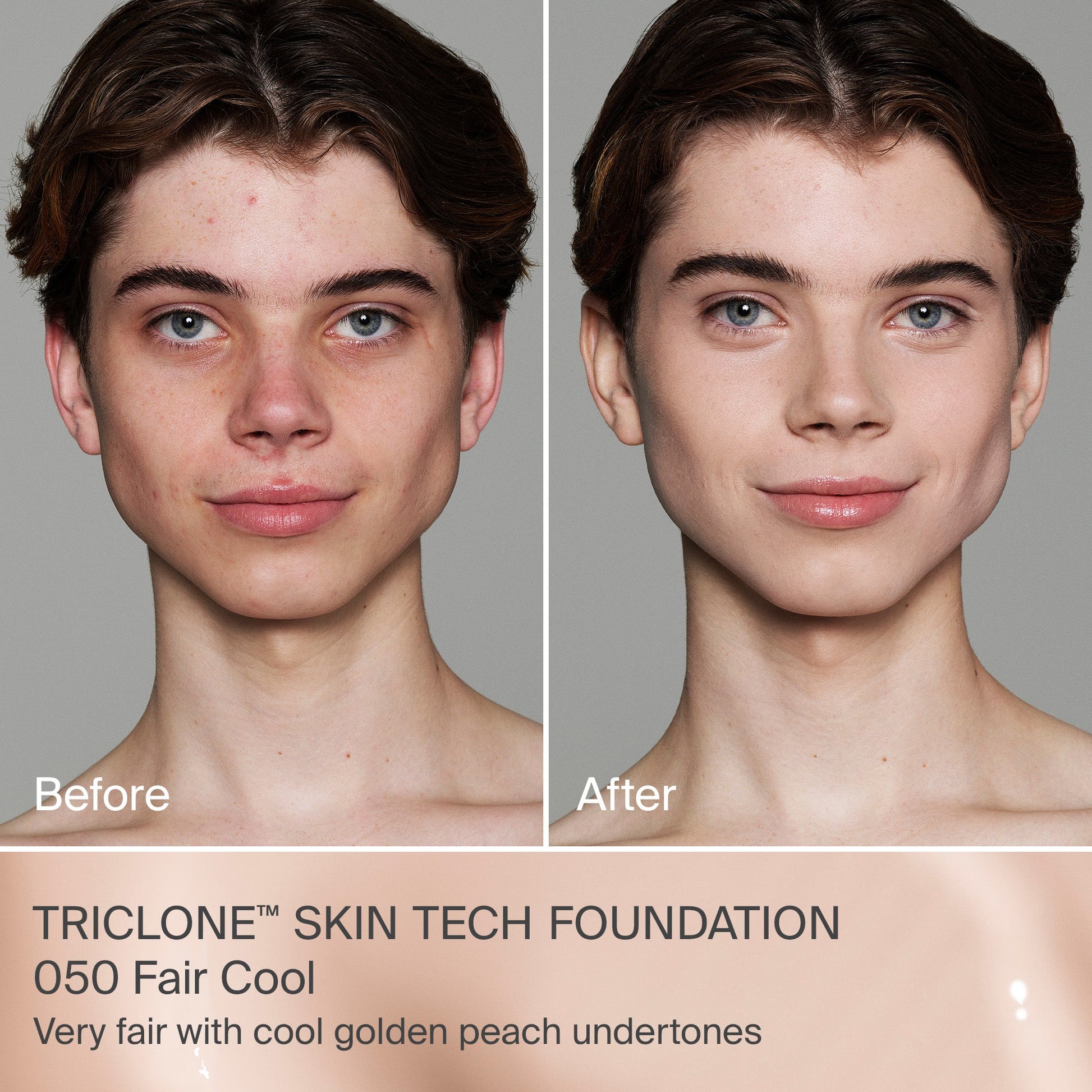 TRICLONE™ SKIN TECH MEDIUM COVERAGE FOUNDATION