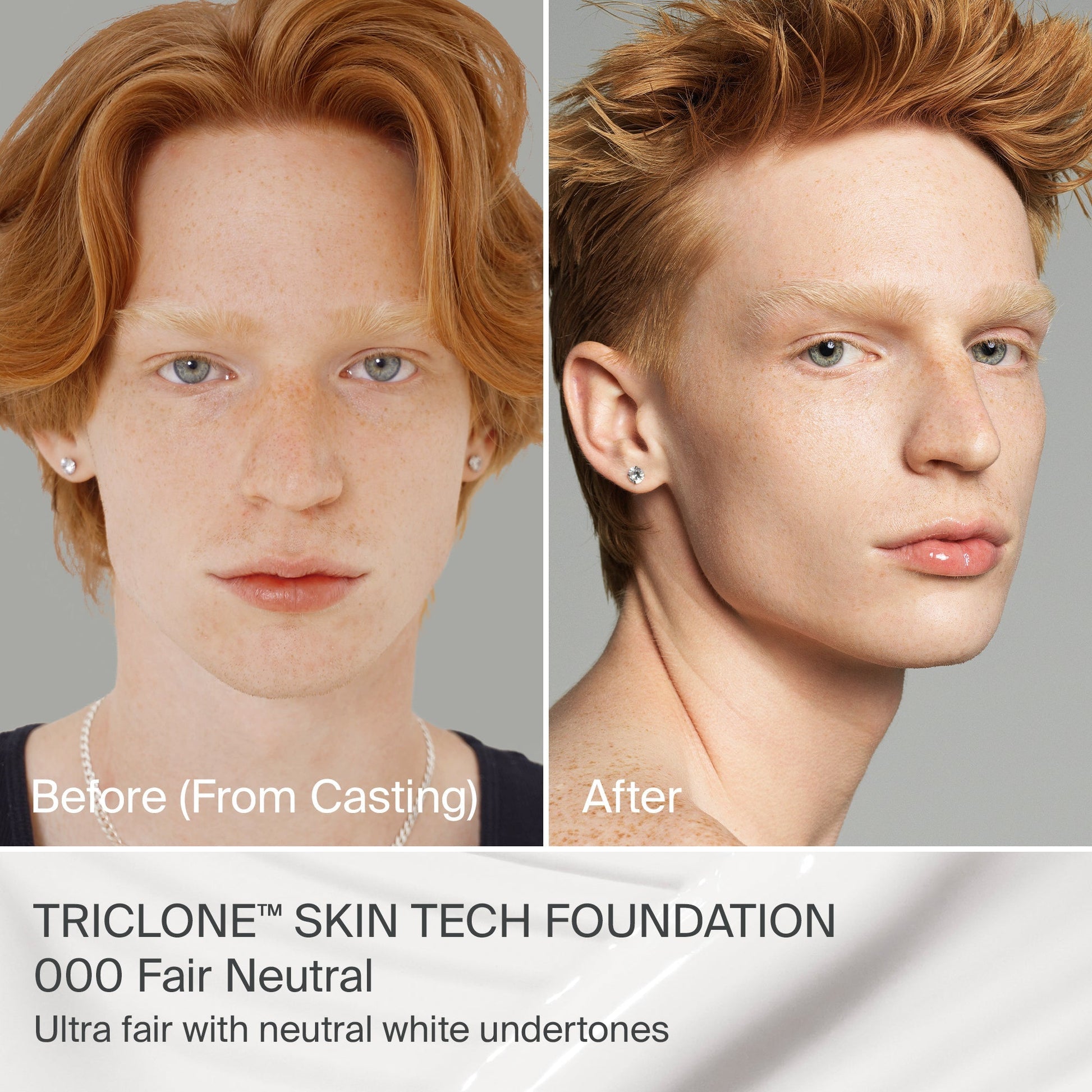 TRICLONE™ SKIN TECH MEDIUM COVERAGE FOUNDATION