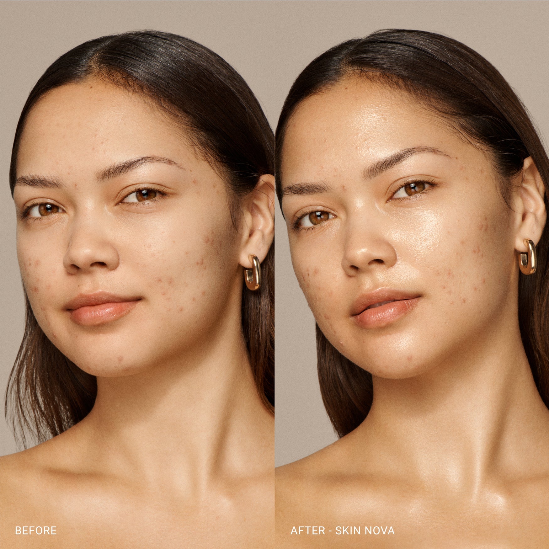 Skin Nova Travel Size