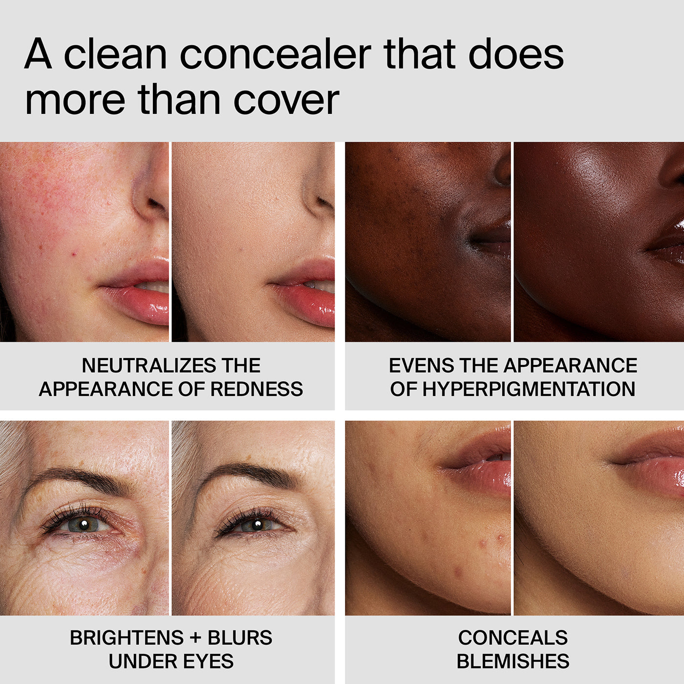 TRICLONE™ SKIN TECH CONCEALER